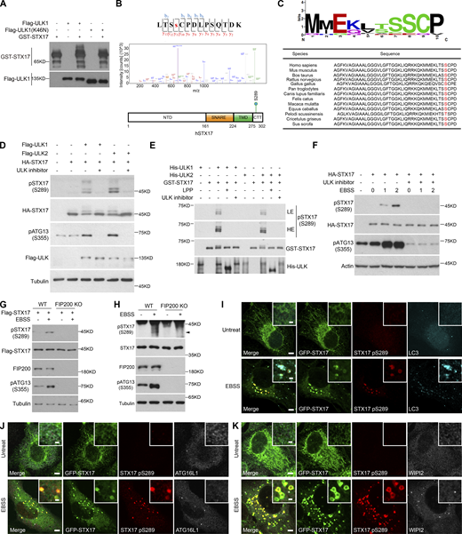 ULK directly phosphorylates STX17 at Ser289. (A) In vitro kinase assay to detect STX17 phosphorylation by ULK1. Flag-ULK1 or Flag-ULK1 (K46N) proteins immunoprecipitated from transfected HEK293T cells were incubated with GST-STX17 purified from E. coli at 30°C for 30 min. Samples were subjected to immunoblot with the indicated antibodies. (B) Identification of STX17 phosphorylation at Ser289. Phosphorylated proteins of GST-STX17 in A were analyzed by mass spectrometry. Results show GST-STX17 phosphorylation by Flag-ULK1 at Ser289 residue. The schematic diagram of the STX17 phosphorylation site at Ser289 is shown. (C) Sequence alignment shows that S289 in different species is highly conserved (analyzed by WebLogo). (D) ULK leads to the phosphorylation of STX17 at Ser289. HEK293T cells were transfected with HA-STX17 and either Flag-ULK1 or Flag-ULK2. 24 h after transfection, cells were subjected to immunoblot with the indicated antibodies. (E) ULK directly phosphorylates STX17 at Ser289. An in vitro kinase assay was performed with purified GST-STX17 and either His-ULK1 or His-ULK2 in the presence or absence of LPP or the ULK inhibitor. Samples were subjected to immunoblot with the indicated antibodies. LE, low exposure; HE, high exposure. (F) EBSS starvation promotes the phosphorylation of STX17 at Ser289. HEK293T cells were transfected with HA-STX17. 24 h after transfection, HEK293T cells were starved with or without EBSS for the indicated hours in the presence or absence of ULK inhibitor. Cells were subjected to immunoblot with the indicated antibodies. (G) Starvation-induced phosphorylation of exogenous STX17 at Ser289 is abolished in FIP200 KO cells. WT and FIP200 KO MEF cells stably expressing Flag-STX17 were treated with or without EBSS for 2 h. Cells were subjected to immunoblot with the indicated antibodies. (H) Starvation-induced phosphorylation of endogenous STX17 at Ser289 is abolished in FIP200 KO cells. WT and FIP200 KO MEF cells were treated with or without EBSS for 2 h. Cells were subjected to immunoblot with the indicated antibodies. The black arrowhead indicates the phosphorylation band of STX17. (I) U2OS cells stably expressing GFP-STX17 were treated with or without EBSS for 2 h. Cells were stained with the indicated antibodies. Scale bar, 5 μm. Inset scale bar, 1 μm. (J) U2OS cells stably expressing GFP-STX17 and Flag-ATG16L1 were treated with or without EBSS for 2 h. Cells were stained with the indicated antibodies. Scale bar, 5 μm. Inset scale bar, 1 μm. (K) U2OS cells stably expressing GFP-STX17 were treated with or without EBSS for 2 h. Cells were stained with the indicated antibodies. Scale bar, 5 μm. Inset scale bar, 1 μm. Source data are available for this figure: SourceData F2. Refer to the image caption for details.