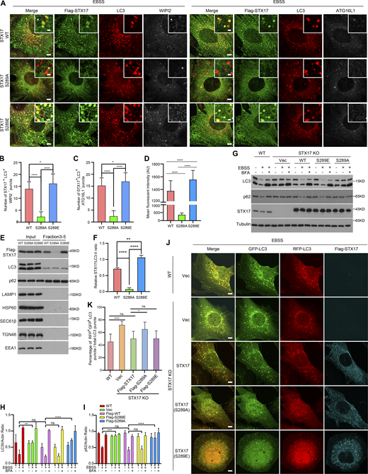 The dephosphorylation of STX17 at Ser289 inhibits its localization to autophagosomes. (A) The dephosphorylation of STX17 at Ser289 fails to translocate to the autophagosome. STX17 KO MEF cells stably expressing Flag-STX17 (WT), Flag-STX17 (S289A), or Flag-STX17 (S289E) were treated with EBSS for 2 h and stained with the indicated antibodies. Scale bar, 5 μm. Inset scale bar, 1 μm. (B) Quantification of the STX17+/WIPI2− autophagosome number. Images in A were analyzed. Data are mean ± SD (n = 3; 100 cells from three independent experiments were quantified). ****P < 0.0001, *P < 0.05, one-way ANOVA. (C) Quantification of the STX17+/ATG16L1− autophagosome number. Images in A were analyzed. Data are mean ± SD (n = 3; 100 cells from three independent experiments were quantified). ****P < 0.0001, *P < 0.05, one-way ANOVA. (D) Quantification of the mean fluorescent intensity of STX17 on autophagosomes in A. Data are mean ± SD (n = 3; 300 autophagosomes from three independent experiments were quantified). ****P < 0.0001, one-way ANOVA. (E) Gradient fractionation analysis of STX17 in autophagosome enriched fractions. HEK293T cells stably expressing Flag-STX17 WT, Flag-STX17 S289A, or Flag-STX17 S289E were starved for 2 h with EBSS, and then separated using the OptiPrep gradient. The fractions from 3 to 5, in a total of 14 fractions, were collected and combined for immunoblot. (F) Quantification of the intensity ratio of STX17/LC3-II in E. The intensity of STX17 mutant bands was normalized to LC3-II. Data are mean ± SEM of three independent experiments. ****P < 0.0001, **P < 0.01, one-way ANOVA. (G) The effect of STX17 S289 phosphorylation on autophagic flux. WT and STX17 KO MEF cells complemented with or without Flag-STX17 WT, Flag-STX17 S289A, or Flag-STX17 S289E were starved with EBSS in the presence or absence of 100 nM BFA for 2 h. Immunoblot was then performed with the indicated antibodies. (H and I) Quantification of LC3-II and p62 band intensity in G. The intensity of LC3-II and p62 bands were normalized to actin. Data are mean ± SEM of three independent experiments. **P < 0.01, ***P < 0.001, ****P < 0.0001, ns, no significance, two-way ANOVA followed by multiple comparison tests. (J) The effect of STX17 S289 phosphorylation on RFP-GFP-LC3 acidification. WT and STX17 KO MEF cells complemented with or without Flag-STX17 WT, Flag-STX17 S289A, or Flag-STX17 S289E were starved with EBSS for 2 h. Cells were then stained with the antibody against Flag and images were taken. Scale bar, 5 μm. (K) Quantification of the percentage of GFP+/RFP+ autophagosomes in J. Data are mean ± SD (n = 3; 100 cells from three independent experiments were quantified). ****P < 0.0001, *P < 0.05, ns, no significance, one-way ANOVA. Source data are available for this figure: SourceData F3.