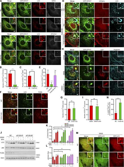 FLNA is required for STX17 recruitment to autophagosomes. (A) FLNA knockdown abolishes the localization of STX17 to autophagosomes. U2OS cells stably expressing GFP-STX17 were transfected with non-targeting siRNA (NC) or siFLNA#2. 48 h after transfection, cells were starved with or without EBSS for 2 h and stained with the indicated antibodies. Scale bar, 5 μm. Inset scale bar, 1 μm. (B) Quantification of the STX17+/LC3+/ATG16L1− autophagosome number. Images in A were analyzed. Data are mean ± SD (n = 3; 100 cells from three independent experiments were quantified). ****P < 0.0001, unpaired two-tailed t test. (C) Quantification of the STX17+/LC3+/WIPI2− autophagosome number. Images in A were analyzed. Data are mean ± SD (n = 3; 100 cells from three independent experiments were quantified). ****P < 0.0001, unpaired two-tailed t test. (D) Wild-type FLNA rescues the deficiency of STX17 recruitment to autophagosomes in FLNA knockdown cells. U2OS cells stably expressing GFP-STX17 and vector or siRNA resistant FLNA-mCherry WT were transfected with non-targeting siRNA (NC) or siFLNA#2. 48 h after transfection, cells were starved with or without EBSS for 2 h, permeabilized before fixation, and then stained with the indicated antibodies. Scale bar, 5 μm. Inset scale bar, 1 μm. (E) Quantification of the number of STX17 positive autophagosomes. Images in D were analyzed. Data are mean ± SD (n = 3; 100 cells from three independent experiments were quantified). ****P < 0.0001, ns, no significance, one-way ANOVA. (F) Localization of FLNA to autophagosomes is independent of STX17. Wild-type and STX17 KO U2OS cells were starved with or without EBSS for 2 h and permeabilized before fixation. Then cells were stained with the indicated antibodies. Scale bar, 5 μm. Inset scale bar, 1 μm. (G) Quantification of the FLNA positive autophagosome number. Images in F were analyzed. Data are mean ± SD (n = 3; 100 cells from three independent experiments were quantified). ns, no significance, unpaired two-tailed t test. (H) STX17 recruitment to autophagosomes is actin-independent. U2OS cells stably expressing GFP-STX17 were starved with EBSS and were treated with or without Latrunculin B for 2 h. Then cells were stained with phalloidin and the indicated antibodies. Scale bar, 5 μm. Inset scale bar, 1 μm. (I) Quantification of the STX17 positive autophagosome number. Images in H were analyzed. Data are mean ± SD (n = 3; 100 cells from three independent experiments were quantified). ns, no significance, unpaired two-tailed t test. (J) Autophagic flux is inhibited in FLNA knockdown cells. WT or FLNA knockdown U2OS cells were starved with EBSS and were treated with or without 100 nM BFA for 2 h and immunoblots were performed with the indicated antibodies. (K and L) Quantification of LC3-II and p62 band intensity in (J). The intensity of LC3-II and p62 bands were normalized to actin. Data are mean ± SEM of three independent experiments. *P < 0.05, **P < 0.01, ***P < 0.001, two-way ANOVA followed by multiple comparison tests. (M) RFP-GFP-LC3 acidification is inhibited in FLNA-deficient cells. U2OS cells stably expressing RFP-GFP-LC3 were transfected with non-targeting siRNA (NC) or siFLNA#2. 48 h after transfection, cells were starved with or without EBSS for 2 h. Scale bar, 5 μm. Inset scale bar, 1 μm. (N) Quantification of the percentage of GFP+/RFP+ autophagosomes in M. Data are mean ± SD (n = 3; 100 cells from three independent experiments were quantified). ****P < 0.0001, unpaired two-tailed t test. Source data are available for this figure: SourceData F5.