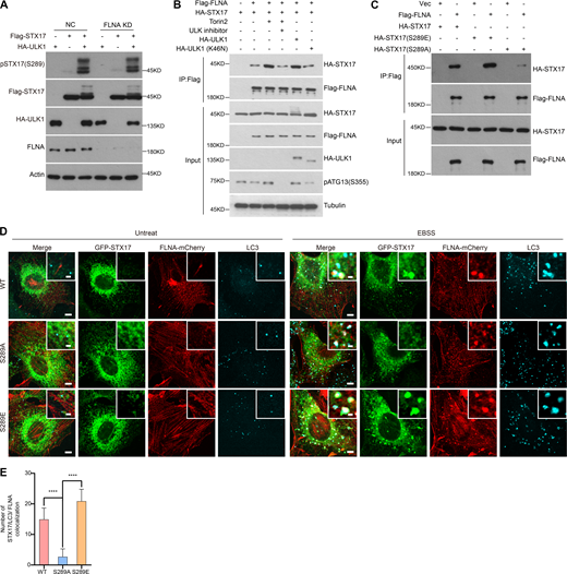 STX17 pS289 increases its interaction with FLNA. (A) FLNA knockdown does not affect the phosphorylation of STX17 at S289. HEK293T cells were transfected with non-targeting siRNA (NC) or siFLNA#2. 24 h after transfection, cells were transfected with indicated plasmids. Another 24 h after transfection, cells were subjected to immunoblot with the indicated antibodies. (B) ULK activation increases the interaction of FLNA with STX17. HEK293T cells were transfected with the indicated plasmids. 24 h after transfection, cells were treated with or without Torin2 or ULK inhibitor for 2 h. Cells were lysed and immunoprecipitated with anti-Flag antibody. Immunoblots were performed with the indicated antibodies. (C) The effect of STX17 Ser289 phosphorylation on its interaction with FLNA. HEK293T cells were transfected with the indicated plasmids. 24 h after transfection, cells were lysed and immunoprecipitated with anti-Flag antibody. Immunoblotting was performed with the indicated antibodies. (D) STX17 S289A and STX17 S289E decrease and increase their colocalization with FLNA compared to STX17 WT, respectively. U2OS cells stably expressing FLNA-mCherry with GFP-STX17 WT, GFP-STX17 S289A, or GFP-STX17 S289E were starved with or without EBSS for 2 h and permeabilized before fixation. Cells were stained with the indicated antibodies. Scale bar, 5 μm. Inset scale bar, 1 μm. (E) Quantification of the FLNA+/STX17+ autophagosome number. Images in D were analyzed. Data are mean ± SD (n = 3; 100 cells from three independent experiments were quantified). ****P < 0.0001, one-way ANOVA. Source data are available for this figure: SourceData F6. Refer to the image caption for details.