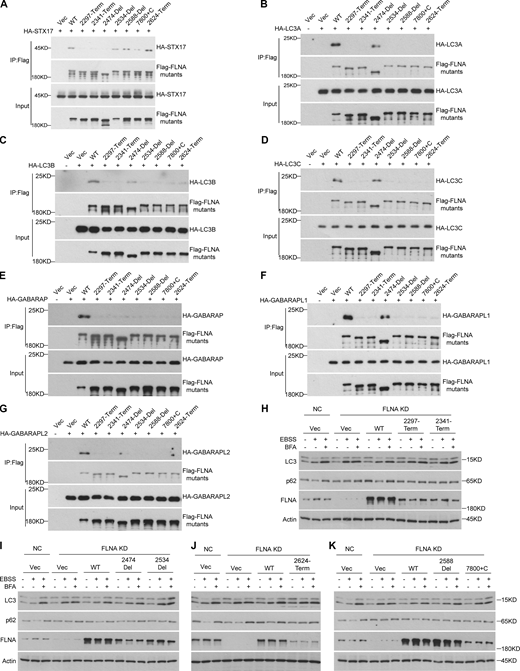 FLNA deficiency disease causative mutations inhibit autophagy. (A) FLNA deficiency disease causative mutations in or around D21-D23 regions disrupt the interaction of FLNA with STX17. HEK293T cells were transfected with the indicated plasmids. 24 h after transfection, cells were lysed and immunoprecipitated with anti-Flag antibody. Immunoblots were then performed with the indicated antibodies. (B–G) FLNA deficiency disease causative mutations in or around H2-D24 regions disrupt its interaction with ATG8s. HEK293T cells were transfected with the indicated plasmids. 24 h after transfection, cells were lysed and immunoprecipitated with anti-Flag antibody. Immunoblots were performed with the indicated antibodies. (H–K) FLNA deficiency disease causative mutations fail to rescue the autophagic flux in FLNA deficient cells. HEK293T cells were transfected with non-targeting siRNA (NC) or siFLNA#2. 24 h after transfection, cells were transfected with different FLNA mutant plasmids. Cells were starved with EBSS with or without 100 nM BFA for 2 h and immunoblots were performed with the indicated antibodies. Source data are available for this figure: SourceData F8.