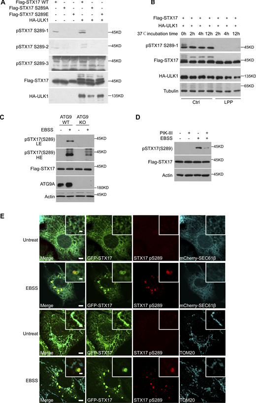 pSTX17 S289 does not localize to ER and mitochondria. (A) Screening of three antibodies to detect STX17 pS289. HEK293T cells were transfected with Flag-STX17 WT, Flag-STX17 S289A, or Flag-STX17 S289E with or without HA-ULK1. 24 h after transfection, cells were subjected to immunoblot with antibodies against Flag, HA, and pSTX17 S289(1-3), respectively. (B) Distinguishing the phosphorylation or dephosphorylation at the residue S289 of STX17 by pSTX17 S289-1. HEK293T cells were transfected with Flag-STX17 WT and HA-ULK1. 24 h after transfection, cells were lysed and the supernatant was treated with or without lambda protein phosphatase for the indicated hours at 37°C and then subjected to immunoblot with the indicated antibodies. (C) WT and ATG9 KO HeLa cells stably expressing Flag-STX17 were treated with or without EBSS for 2 h. Cells were subjected to immunoblot with the indicated antibodies. (D) HeLa cells stably expressing Flag-STX17 were treated with PIK-III for 30 min, or with EBSS for 2 h, or pretreated with PIK-III for 30 min and then treated with EBSS for 2 h. Cells were subjected to immunoblot with the indicated antibodies. (E) STX17 pS289 does not localize to the ER or mitochondria. U2OS cells stably expressing GFP-STX17 were transfected with or without mCherry-Sec61β. 24 h after transfection, cells were starved with or without EBSS for 2 h. Cells were stained with the indicated antibodies. Pseudo colors were used for mCherry-Sec61β and STX17 pS289 in the upper panel. Scale bar, 5 μm. Inset scale bar, 1 μm. Source data are available for this figure: SourceData FS2. Refer to the image caption for details.
