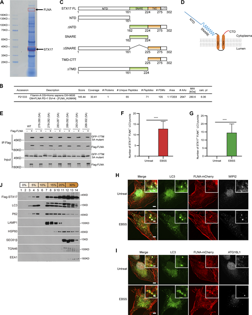 FLNA interacts with STX17 and does not localize to isolation membranes. (A) Coomassie blue staining of the STX17 immunoprecipitation sample. HEK293T cells stably expressing Flag-STX17 were lysed and immunoprecipitated with anti-Flag antibody and eluted for Coomassie blue staining. (B) Mass spectrometric analysis of FLNA in Flag-STX17 immuno-precipitates. (C) Schematic diagram of STX17 truncated variants. (D) Schematic diagram of STX17 topology structure. (E) Alanine scanning analysis of STX17 C-terminal domain. HEK293T cells were transfected with GFP-STX17 TMD-CTT variants with or without Flag-FLNA. 24 h after transfection, cells were lysed and immunoprecipitated with anti-Flag. Immunoblot was then performed with the indicated antibodies. (F and G) Quantification of the number of STX17+LC3+FLNA− puncta during EBSS starvation in Fig. 4 H and 4 I. Data are mean ± SD (n = 3; 100 cells from three independent experiments were quantified). ****P < 0.0001, unpaired two-tailed t test. (H and I) U2OS cells stably expressing FLNA-mCherry were starved with or without EBSS for 2 h and then permeabilized before fixation. Cells were stained with the indicated antibodies. Scale bar, 5 μm. Inset scale bar, 1 μm. (J) HEK293T cells stably expressing Flag-STX17 were starved for 2 h with EBSS and subjected to OptiPrep fractionation. 14 fractions were collected for immunoblot. Source data are available for this figure: SourceData FS4.