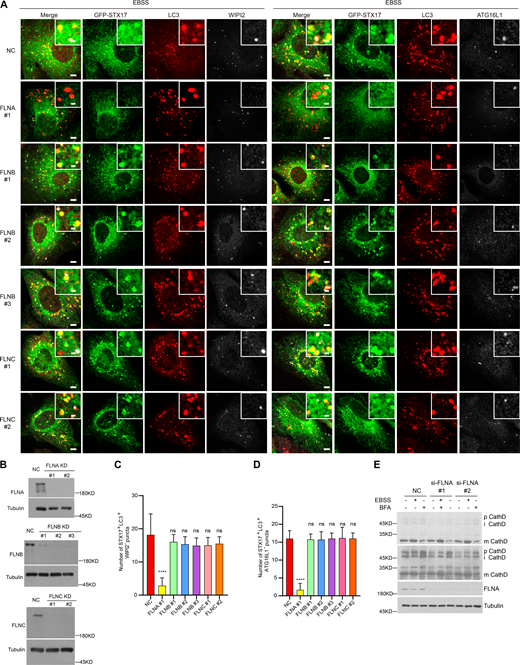 Depletion of FLNB and FLNC does not affect the recruitment of STX17 to autophagosomes. (A) Knockdown of FLNA, but not FLNB and FLNC, abolishes the STX17 recruitment to autophagosomes. U2OS cells stably expressing GFP-STX17 were transfected with non-targeting siRNA (NC) or siRNA against FLNA, FLNB, or FLNC, respectively. 48 h after transfection, cells were starved with EBSS for 2 h and stained with the indicated antibodies. Scale bar, 5 μm. Inset scale bar, 1 μm. (B) U2OS cells were transfected with the indicated siRNAs. 48 h after transfection, cells were subjected to immunoblot with the indicated antibodies. (C) Quantification of the STX17+/LC3+/WIPI2− autophagosome number. Images in A were analyzed. Data are mean ± SD (n = 3; 100 cells from three independent experiments were quantified). ****P < 0.0001, ns, no significance, one-way ANOVA. (D) Quantification of the STX17+/LC3+/ATG16L1− autophagosome number. Images in A were analyzed. Data are mean ± SD (n = 3; 100 cells from three independent experiments were quantified). ****P < 0.0001, ns, no significance, one-way ANOVA. (E) Knockdown of FLNA does not alter cathepsin D processing. U2OS cells were transfected with no-targeting siRNA (NC) or siRNAs against FLNA. 48 h after transfection, cells were starved with EBSS or treated with 100 nM BFA for 24 h. Then cells were collected for immunoblot with the indicated antibodies. Source data are available for this figure: SourceData FS5. Refer to the image caption for details.