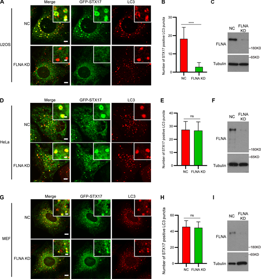 FLNA-dependent STX17 recruitment is a cell-specific mechanism. (A, D, and G) U2OS, HeLa, and MEF cells stably expressing GFP-STX17 were transfected with siRNA against FLNA. 48 h after transfection, cells were starved with EBSS for 2 h and then stained with LC3B antibody. Scale bar, 5 μm. Inset scale bar, 1 μm. (B, E, and H) Quantification of the number of STX17/LC3 positive puncta in U2OS, HeLa, and MEF cells stably expressing GFP-STX17. Data are mean ± SD (n = 3; 100 cells from three independent experiments were quantified). ****P < 0.0001, ns, no significance, unpaired two-tailed t test. (C, F, and I) FLNA knockdown efficiency in U2OS, HeLa and MEF cells stably expressing GFP-STX17. Cells were transfected with the siFLNA. 48 h after transfection, cells were subjected to immunoblot with the indicated antibodies. Source data are available for this figure: SourceData FS8. Refer to the image caption for details.