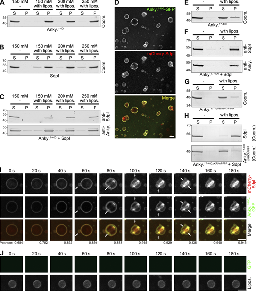 Ankycorbin and syndapin I associate at liposome membrane surfaces. (A–C) Ankycorbin and syndapin I analyzed individually (A and B) and in combination (C) in liposome binding assays and extraction attempts using increasing salt concentrations (150, 200, 250 mM NaCl) evaluated by Coomassie staining of SDS-PAGE gels (A and B) and by immunoblotting (C). S, supernatant; P, pellet. (D) Colocalization of purified mCherry-syndapin I and ankycorbin1-400-GFP at liposome surfaces. Bar, 5 µm. (E–H) Liposome binding assays with ankycorbin17-400 alone (E) and ankycorbin17-400∆KRKAPPPP (G) alone as well as each in combination with syndapin I (F and H). Note that whereas ankycorbin17-400 is unable to effectively bind to liposomes (E), syndapin I recruits it to membranes in a KRKAPPPP-dependent manner (F and H). (For experiments corresponding to E and F demonstrating resistance to salt extraction upon syndapin I presence, see Fig. S2.) Shown are Coomassie staining of individual proteins (E and G) and immunoblottings in the combination of ankycorbin17-400 and syndapin I (F), whereas the combination with the mutant ankycorbin17-400∆KRKAPPPP had to be shown by Coomassie staining (H) as the anti-ankycorbin antibody epitope is lacking in the mutant. (I and J) MIPs of live 3D spinning-disc microscopy of reconstitutions with liposomes and purified, recombinant ankycorbin1-400-GFP and mCherry-syndapin I (I) and of control experiments with GFP (not recruited to Cy5-phosphatidylethanolamine-marked liposomes; J). Arrows in I mark newly appearing, strongly curved membrane structures. Numbers added beneath each frame in I represent Pearson correlation coefficients. Bars, 5 µm. Source data are available for this figure: SourceData F3. Refer to the image caption for details.