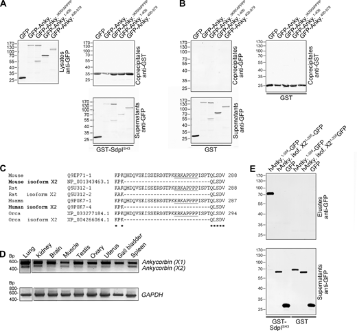 The syndapin I SH3 domain coprecipitates ankycorbin but not a splice variant thereof that occurs in both mice and man, yet shows particularly low expression in gall bladder and brain. (A) Supplementary data related to the coprecipitation analyses with immobilized GST-syndapin I SH3 domain (GST-SdpISH3; Fig. 1 D) showing the anti-GFP immunoblotting of supernatants (lysates are repeated for comparison) and the anti-GST immunoblotting of the immobilized proteins in the eluates. (B) Specificity controls related to the coprecipitations shown in Fig. 1 D (immobilized GST instead of GST-syndapin I SH3 domain). (C) Alignment of ankycorbin (X1 isoforms; a isoforms) of several exemplary species with the respective predicted X2 (b) isoforms lacking an exon encoding for a region containing the syndapin I–binding KRKAPPPP motif (underlined). Conserved residues are marked (*). Ankycorbin X2 splice isoforms experimentally demonstrated to exist by cloning and sequencing from cDNA from different sources are in bold. (D) RT-PCR analysis of different (adult) murine tissues for the expression of the ankycorbin X1 (a) isoform (upper, strong band) and the ankycorbin X2 (b) isoform (lower band) sequences. GAPDH is shown as control. Note that ankycorbin X2 is a widely expressed variant of low abundance and is particularly hard to detect in brain and gall bladder. The identity of both RT-PCR bands (ankycorbin X1 and ankycorbin X2) was confirmed by cloning and sequencing of the RT-PCR products. (E) Coprecipitation experiments show that, in contrast to human ankycorbin (X1), the human ankycorbin X2 isoform does not bind to immobilized GST-syndapin I SH3 domain (GST-SdpISH3). Source data are available for this figure: SourceData FS1. Refer to the image caption for details.