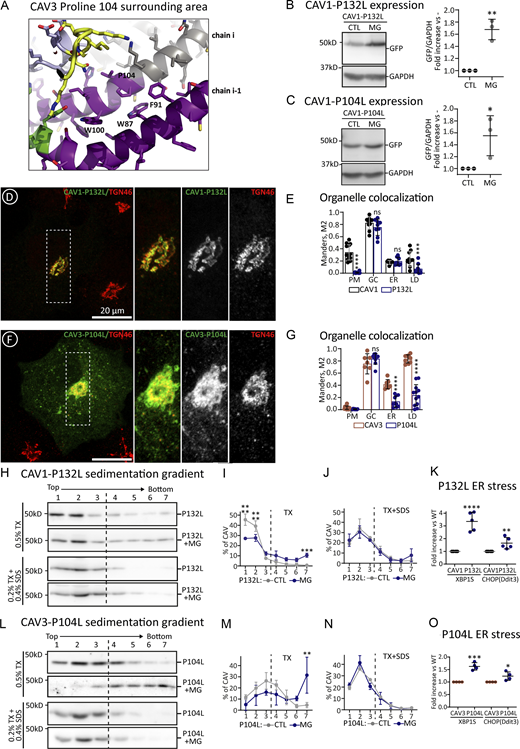 Oligomerization defective caveolin mutants aggregate and cause ER stress. (A) The scheme shows a detail of the position and interactions of the Pro 104 of human CAV3 within the oligomer predicted by AlphaFold2 (shown in ribbon diagram and colored according to the pLDDT score; Fig. 1 for additional details). (B and C) GFP-tagged CAV1-P132L (B) and CAV3-P104L (C) were expressed for 3 h in untreated cells or in cells additionally treated with MG132 and protein steady levels determined as in Fig. 2 B (n = 3 independent experiments). (D–G) The distribution of the mutants after 3 h was analyzed by confocal microscopy. (D and F) show representative images of the mutants and their colocalization with TGN36 (GC marker). Additional images are included in Fig. S5. (E and G) show the colocalization of the mutants with organellar markers calculated as in Fig. 2 H (n ≥ 3 independent experiments and at eight cells per condition). (H–O) Cells were transfected with GFP-tagged CAV1-P132L or CAV3-P104L and expressed in CTL cells or cells additionally treated with MG132. After 3 h cells were solubilized with either TX or TX+SDS and fractionated in sucrose sedimentation gradients as in Fig. 2, K and M. Protein distribution was quantified in equal volumes of each fraction by IB with anti-GFP antibodies. (H and L) shows a representative result and (I, J, M, and N) the relative distribution of each protein in each fraction of the gradient calculated by densitometry (n = 3 independent experiments). (K and O) CAV1 and CAV1-P132L or CAV3 and CAV3-P104L were transfected in parallel for 16 h and the ER stress evaluated by measuring expression of XBP1 and DDIT3 by qPCR. Results are referred to the expression of the stress markers in cells transfected with the wt caveolins (n ≥ 4 independent experiments). All graphs show means ± SD; ns, not significant; *P < 0.05, **P < 0.01, ***P < 0.001, ****P < 0.0001 in a two-tailed paired t test (B and C, and stress in K and O) two-way ANOVA test (E and G) and sedimentation gradient in I, J, O, and P. Scale bars are 20 μm. Source data are available for this figure: SourceData F6.