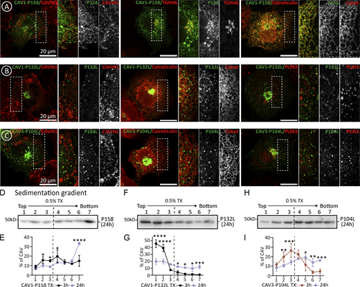 Intracellular distribution of caveolin pathogenic mutants. Supplemental for Figs. 5 and 6. (A–C) CAV1-P158, CAV1-P132L, and CAV3-P104L were expressed for 3 h. Proteins were colocalized with antibodies recognizing Cavin-1 (PM caveolae), TGN46 (GC), Calreticulin (ER), and Plin-3 (LDs) and analyzed by confocal microscopy. (D–I) Mutants were expressed for 24 h. Cells were solubilized in TX and fractionated in sedimentation gradients as in Fig. 2 K. The IB shows representative experiments and the graphs the average distribution when compared to the 3 h expression (n ≥ 3 independent experiments). All graphs show means ± SD; ns, not significant; *P < 0.05, **P < 0.01, ***P < 0.001, ****P < 0.0001 in a two-way ANOVA test (E, G, and I). Scale bars are 20 μm. Source data are available for this figure: SourceData FS5.