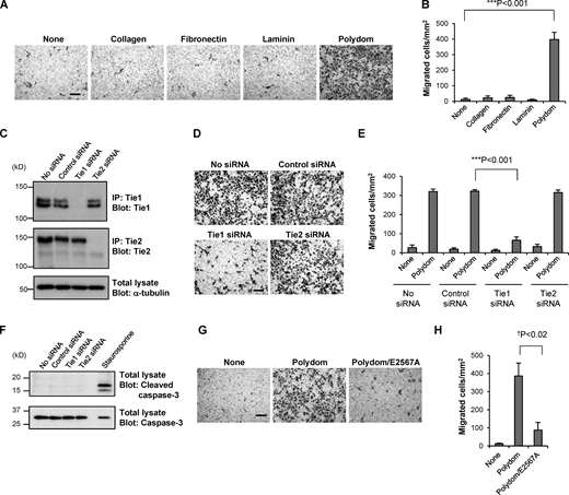 Polydom promotes LEC migration via Tie1. (A) Photographs of LECs that migrated to the lower side of Transwell membranes in the presence of collagen, fibronectin, laminin, or Polydom (3 μg/ml) added to the lower chamber medium. The molar concentration of the proteins was collagen, 23 nM; fibronectin, 15 nM; laminin, 3.8 nM; and Polydom: 8.8 nM. Bar, 200 μm. (B) Cells that migrated to the lower side of the membranes were counted under a microscope. The data represent means ± SD of three independent experiments each assayed in triplicate. ***P < 0.001 (n = 3). (C) Immunoprecipitates (IP) of Tie1 and Tie2 from lysates of LECs transfected with control, Tie1, or Tie2 siRNAs were analyzed by Western blotting under reducing conditions. The same lysates were probed with an antibody against α-tubulin as a control. The positions of molecular weight markers are shown on the left. (D) LECs transfected with control, Tie1, or Tie2 siRNAs were allowed to migrate in the presence of Polydom (1 μg/ml) for 16 h. Bar, 200 μm. (E) Cells that migrated to the lower side of the membranes were counted under a microscope in the absence (none) or presence of Polydom added to the lower chamber medium. The data represent means ± SD of three independent experiments each assayed in triplicate. ***P < 0.001 (n = 3). (F) Total lysates of LECs transfected with control, Tie1, or Tie2 siRNAs were analyzed by Western blotting using anti-cleaved caspase-3 and anti-caspase-3 antibodies under reducing conditions. Lysates of LECs treated with staurosporine (0.2 μM, 4 h) were used as a positive control for cleaved caspase-3 detection. (G) Photographs of LECs that migrated to the lower side of the membranes in the presence of Polydom or Polydom/E2567A (1 μg/ml) in the lower chamber medium. Bar, 200 μm. (H) Cells that migrated to the lower side of the membranes were counted under a microscope. The data represent means ± SD of three independent experiments each assayed in triplicate. †P < 0.02 (n = 3). Source data are available for this figure: SourceData F3.