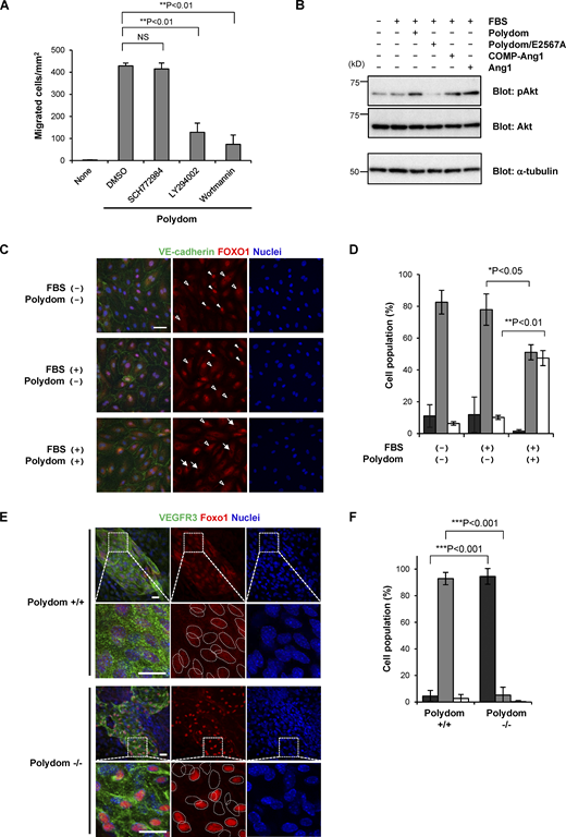 Involvement of the PI3K/Akt signaling pathway in Polydom-induced LEC migration. (A) LECs were allowed to migrate to the lower side of Transwell membranes in the absence (none) or presence of Polydom (1 μg/ml) with an ERK inhibitor (2 μM SCH772984) or PI3K inhibitors (20 μM LY294002 or 2 μM Wortmannin) added to the lower chamber medium. Cells that migrated to the lower side of the membranes were counted under a microscope. The data represent means ± SD of three independent experiments each assayed in triplicate. NS, not significant; **P < 0.01 (n = 3). (B) Serum-starved LECs were treated with Polydom (1 μg/ml), Polydom/E2567A (1 μg/ml), COMP-Ang1 (500 ng/ml), or Ang1 (500 ng/ml) in medium containing 0.5% FBS at 37°C for 15 min. Total lysates of the cells were immunoblotted for pAkt or total Akt under reducing conditions. (C) Serum-starved LECs were treated with Polydom (1 μg/ml) in medium with or without 0.5% FBS at 37°C for 30 min, followed by immunostaining for VE-cadherin (green) and FOXO1 (red). Nuclei were stained with Hoechst 33342 (blue). Cells in which FOXO1 was excluded from the nucleus (arrows) were frequently observed in the presence of Polydom, while FOXO1 was detected exclusively in the nucleus (closed arrowheads) or both the nucleus and cytoplasm with reduced signal intensity (open arrowheads) in the absence of Polydom. Bar, 20 μm. (D) Quantification of the percentages of cells showing FOXO1 localization in the nucleus only (black), in both the nucleus and the cytoplasm (gray), and in the cytoplasm only (white). The data represent means ± SD of three independent experiments. *P < 0.05 and **P < 0.01 (n = 3). (E) Whole-mount immunofluorescence staining of the skin of E17.5 wild-type (Polydom+/+, upper panels) and Polydom-deficient mice (Polydom−/−, lower panels) for VEGFR3 (green, used as a lymphatic vessel marker) and Foxo1 (red). Nuclei were stained with Hoechst 33342 (blue). Magnified views of the boxed areas are shown below. Individual nuclei are encircled with dotted lines in the magnified views for Foxo1 staining. Bars, 20 μm. (F) Quantification of the percentages of VEGFR3-positive cells showing Foxo1 localization in the nucleus only (black), both in the nucleus and the cytoplasm (gray), and in the cytoplasm only (white) in Polydom+/+ and Polydom−/− mice. The data represent means ± SD. ***P < 0.001 (n = 3 per genotype). Source data are available for this figure: SourceData F4.