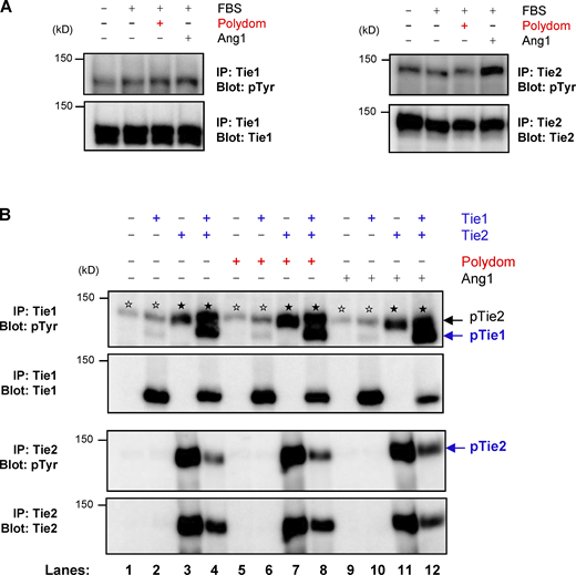 Polydom does not induce Tie1 phosphorylation. (A) Serum-starved LECs were treated with EBM-MV2 medium containing 0.5% FBS, 1 μg/ml Polydom, or 500 ng/ml Ang1 at 37°C for 15 min. Immunoprecipitates (IP) of Tie1 (left) and Tie2 (right) from cell lysates were immunoblotted under reducing conditions for phosphotyrosine residues (upper panels) followed by reimmunoblotting for total Tie1 or Tie2 (lower panels). (B) 293-F cells were transfected with the indicated expression plasmids for Tie1 and Tie2 and treated with 1 μg/ml Polydom or 500 ng/ml Ang1 at 37°C for 15 min. Immunoprecipitates of Tie1 and Tie2 from cell lysates were immunoblotted under reducing conditions for phosphotyrosine residues (upper panels), followed by reimmunoblotting for total Tie1 or Tie2 (lower panels). Co-transfection of Tie2 with Tie1 increased Tie1 phosphorylation irrespective of the presence or absence of Polydom (lanes 4, 8, and 12). No Tie1 phosphorylation was induced by Polydom without Tie2 co-transfection (lanes 2, 6, and 10). Signals for phosphorylated Tie2 (pTie2; closed stars) were detected in Tie1 immunoprecipitates from Tie2-transfected cells (uppermost panel; lanes 3, 4, 7, 8, 11, and 12) because the anti-Tie1 polyclonal antibody used for the immunoprecipitation crossreacts with Tie2. Weak signals (open stars) were detected at (or slightly above) the position of pTie2 in the Tie1 immunoprecipitates from cells that were either untransfected or only transfected with Tie1 (lanes 1, 2, 5, 6, 9, and 10). Because Tie2 was not transfected in these cells, the weak signals (open stars) at the pTie2 position should be derived from tyrosine-phosphorylated proteins that were endogenously expressed in 293-F cells and nonspecifically precipitated with the anti-Tie1 antibody used. Such bands were not detected in untransfected or Tie1-transfected cells after immunoprecipitation with an anti-Tie2 antibody (lower panels; lanes 1, 2, 5, 6, 9, and 10). Source data are available for this figure: SourceData FS3.