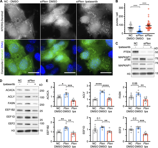 Inhibition of CMA by siPten is reversed by inhibiting AKT. (A) Fluorescent microscopy images of AML12 hepatocytes expressing a KFERQ-Dendra2 CMA reporter that were chemically transfected with the indicated siRNAs and then treated with ipatasertib (Ipa) or DMSO solvent control. (B) Quantifications of CMA puncta, as seen in A, which were reduced by siPten and rescued by ipatasertib treatment. Data points are individual cells, pooled from at least three replicates, n = 51, 38, 39 (for NC.DMSO, siPten.DMSO, and siPten.Ipa, respectively). (C) AML12 cells were treated as described in A and B and lysed for Western blotting, which showed that siPten caused an increase in the phosphorylation of AKT substrate MAPKAP1, which was rescued by ipatasertib. (D) Western blots showing the effects of siPten and ipatasertib rescue on CMA-sensitive proteins. (E) Quantifications of blots for the experiment shown in D, adjusted to H3 loading control; n = 6 for each group. Scale bars are 20 μM. On all graphs, the solid bar shows the mean. Error bars are SEM. P values shown on graphs for Western blots are from two-tailed unpaired t tests. P values shown on graphs for CMA reporter puncta are from Kolmogorov–Smirnov tests. *P < 0.05, **P < 0.01, ***P < 0.001, ****P < 0.0001. Source data are available for this figure: SourceData F4. Refer to the image caption for details.