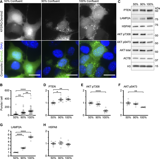 Data supportingFig. 2—CMA activity and PTEN levels increase with the confluence in AML12 cells. (A) Fluorescent microscopy images of AML12 cells expressing a KFERQ-Dendra2 CMA reporter that were plated on glass coverslips and grown to the indicated confluence before being fixed for microscopy. (B) Quantification of puncta from the experiment shown in A, showing increasing CMA activity with increased confluence. Data points are individual cells, pooled from at least three replicates, n = 34, 39, 48 (for 50, 90, and 100% confluence, respectively). (C) Western blots of lysates from AML12 cells grown to the indicated confluence. For D–H, n = 6 for each group. (D) Quantification of PTEN protein levels, adjusted to the H3 loading control, showing increased PTEN in more confluent cells. (E and F) Quantification of AKT pT308 and AKT pS473, respectively. Both are adjusted to total AKT as a loading control. (G) Quantification of LAMP2A protein levels, adjusted to the H3 loading control, showing increased LAMP2A in more confluent cells. (H) Quantification of HSPA8 protein levels, adjusted to the H3 loading control, showing that HSPA8 is unchanged with confluence. Scale bars are 20 μM. On all graphs, the solid bar shows the mean. Error bars are SEM. P values shown on graphs for Western blots are from two-tailed unpaired t tests. P values shown in B are from Kolmogorov–Smirnov tests. *P < 0.05, **P < 0.01, ***P < 0.001, ****P < 0.0001. Source data are available for this figure: SourceData FS3.