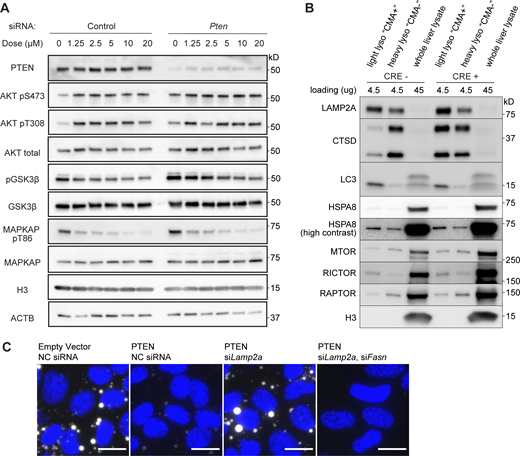 Data supportingFigs. 4and5—controls supporting validity of experimental findings. (A) Western blots of dose curves for Ipatasertib in AML12 cells pretreated with either negative control siRNA or siPten, examining the phosphorylation of AKT and AKT substrates GSK3β and MAPKAP1. (B) Western blots of light lysosome fractions, heavy lysosome fractions, and whole liver lysates from control and liver pten knockout mice. RICTOR and HSPA8 are markers of light (CMA+) lysosomes and RAPTOR is a marker of heavy (CMA−) lysosomes. (C) Fluorescence images from Fig. 9 of BODIPY (white), merged with images of DAPI (blue) to show the cells in each image, even where BODIPY staining is nearly absent. Source data are available for this figure: SourceData FS5.
