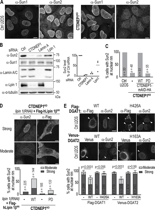 Sun2 localization and protein levels are sensitive to lipid metabolism. (A) Confocal images of U2OS control and CTDNEP1 KO cells immunostained with antibodies against indicated proteins. (B) Immunoblot of cell lysates from control U2OS cells treated with indicated siRNAs. Right: Plot of quantification of relative Sun2 band intensities normalized to tubulin under indicated conditions as percentage of control. Each dot indicates an independent experiment. (C) Plot of quantification of Sun2 localization at nuclear rim in indicated conditions. n indicates the number of cells quantified. (D) Representative images of immunostained CTDNEP1 KO cells showing different categories of Sun2 localization at nuclear rim and plot of blind quantification under indicated conditions. n indicates the number of cells quantified pooled from two independent experiments. (E) Confocal images of immunostained U2OS cells expressing indicated constructs. Plot shows blind quantification of Sun2 localization at nuclear rim. n indicates the number of cells quantified. P values: Fisher’s exact test (moderate vs. others) with N = 3 independent experiments (mean + SD is shown). All scale bars: 10 µm. Source data are available for this figure: SourceData F2. Refer to the image caption for details.