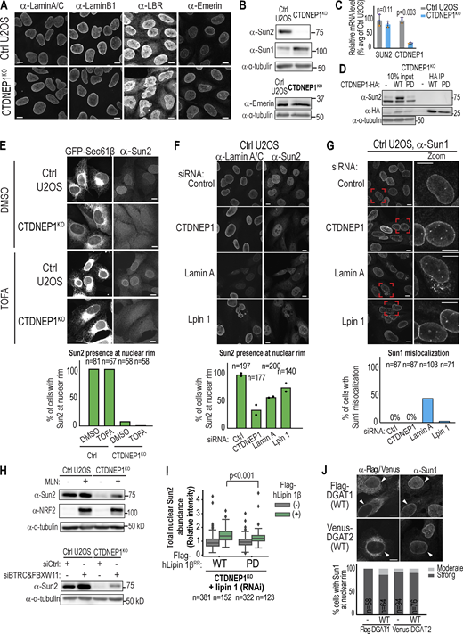 Selective loss of Sun2 protein at the nuclear rim in CTDNEP1 KO cells is dependent on SCFbTRCP and DAG metabolism, related to Fig. 2.(A) Immunofluorescence with indicated antibodies in U2OS cells. (B) Immunoblot of lysates from U2OS cells with indicated antibodies. (C) qRT-PCR of indicated cell lines for indicated genes, shown as fold change in expression relative to mean control values. n = 3 biological replicates (mean and SD). Each pair of replicates is color-coded. P values: paired t test. (D) Immunoprecipitation using anti-HA antibodies of lysates from CTDNEP1 KO cells without (−) or with stable expression of indicated constructs. (E) Max projected spinning disk confocal images and plot representing categorization of Sun2 localization at nuclear rim in indicated cell lines transiently expressing GFP-Sec61β and treated with TOFA. (F and G) Immunofluorescence with indicated antibodies in control U2OS cells treated with indicated siRNAs and plots representing categorization Sun2 or Sun1 at the nuclear rim. For G: boxed regions are magnified in the right column. (H) Immunoblot of lysates from U2OS cells with indicated antibodies and treatments. MLN is MLN4924; siRNA against BTRC and FBXW11 was used to RNAi-deplete SCFb-trcp. (I) Boxplot representing automated fluorescence intensity quantification of Sun2 in the nuclear area (see Materials and methods) under indicated conditions. Data were pooled from two independent experiments. P values: Tukey HSD test. (J) Immunofluorescence of control U2OS cells transiently expressing indicated constructs. Plot represents blind categorization of Sun1 localization at nuclear rim. Scale bars, 10 µm. In E–G, I, and J, n indicates the number of cells that were quantified. Source data are available for this figure: SourceData FS2. Refer to the image caption for details.