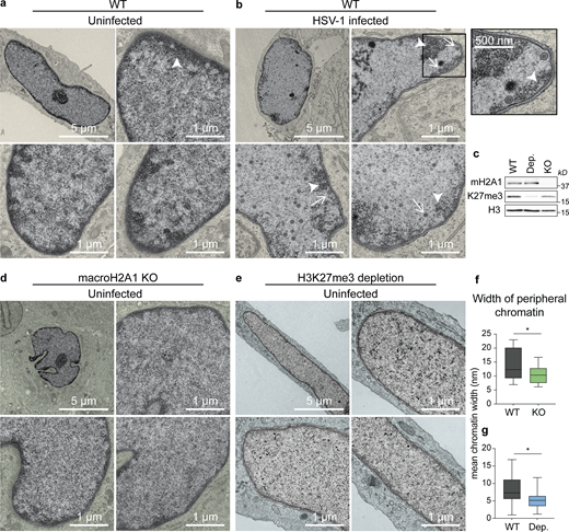 HSV-1 capsids navigate through regions of less dense chromatin to reach the inner nuclear membrane in HFF cells. (a) TEM images of representative uninfected nuclei in WT HFF-Ts. Regions outside of the nucleus are colorized yellow. Dark regions represent high-density chromatin (arrowhead). Scale bars as indicated. (b) TEM images of representative WT nuclei at 18 hpi with HSV-1. Inset shows an enlarged view of the respective boxed area. The arrowhead indicates high-density chromatin, arrows indicate HSV-1 capsids. (c) Representative Western blots with proteins as indicated showing macroH2A1 KO and H3K27me3 depletion (Dep.). (d) TEM images of representative uninfected nuclei in macroH2A1 knockout HFF-T cells. Regions outside of the nucleus are colorized green. (e) TEM images of representative uninfected nuclei in H3K27me3 depleted conditions. Regions outside of the nucleus are colorized blue. (f) Quantification of peripheral heterochromatin width in nuclei from a and d. Width was measured in nm from the nuclear periphery via binary thresholding from intensity profiles sampled every 10 pixels. Mean width was plotted for each nucleus. P = 0.0275 (n = 16 WT, n = 22 macroH2A1 KO) by unpaired t test. For the box plot, the box marks upper and lower quartiles, center line marks median, and error bars denote minimum and maximum values for the population. (g) Quantification as in f in nuclei from a and e. P = 0.0144 (n = 22 WT, n = 20 H3K27me3 depleted) by unpaired t test. For the box plot, the box marks upper and lower quartiles, center line marks median, and error bars denote minimum and maximum values for the population. Source data are available for this figure: SourceData F1.
