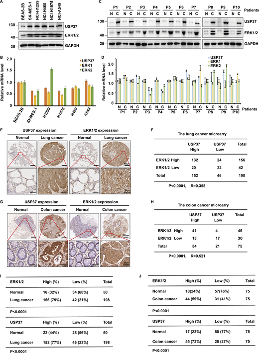 USP37 is positively correlated to ERK1/2 in clinical cancer samples. (A) Cell lysates from several lung cancer cell lines were blotted with USP37 and ERK1/2 antibodies. Lysates from normal lung epithelial cell line BEAS-2B were used as a control. (B) The mRNAs were extracted from the rest of the cancer cells from A and subjected to qRT-PCR. β-actin served as an endogenous control. Data was represented as the means ± SD of three independent experiments. (C) Lung cancer tissue and corresponding normal lung tissues were blotted with USP37 and ERK1/2 antibodies. Lysates from corresponding normal lung tissues were used as a control. (D) The mRNAs were extracted from the rest of the tissue from C and subjected to qRT-PCR. β-actin served as an endogenous control. Data was represented as the means ± SD of three independent experiments. (E) Representative images of immunohistochemical staining of USP37 and ERK1/2 in normal and lung cancer tissue microarray. Scale bars, 300 or 50 μm. (F) Correlation study of ERK1/2 and USP37 in lung cancer. Statistical analyses were performed with χ2 test. R, Pearson correlation coefficient. (G) Representative images of immunohistochemical staining of USP37 and ERK1/2 in normal and colon cancer. Scale bars, 300 or 50 μm. (H) Correlation study of ERK1/2 and USP37 in colon tissue microarray. Statistical analysis was performed with χ2 test. R, Pearson correlation coefficient. (I) Quantification of ERK1/2 and USP37 protein levels in normal and lung cancer tissue microarray. Statistical analyses were performed with χ2 test. (J) Quantification of ERK1/2 and USP37 protein levels in normal and colon tissue microarray. Statistical analyses were performed with χ2 test. Source data are available for this figure: SourceData F7. Refer to the image caption for details.