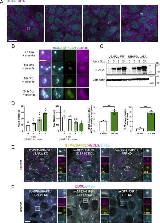 UBAP2L regulates SG–PB association under stress independently of G3BP or Fragile X-related proteins. Tet-inducible GFP-UBAP2L-WT/UBAP2L KO (GFP-UBAP2L) and GFP-UBAP2L-LALA/UBAP2L KO (GFP-LALA) U2OS cells were treated with 100 ng/ml dox for 0, 5, 8, and 24 h to induce varying levels of UBAP2L-WT or UBAP2L-LALA (Fig. S4 A) prior to treatment with arsenite (250 µM, 60 min). LALA is a mutant version of UBAP2L unable to bind G3BP1 (Baumgartner et al., 2013; Youn et al., 2018). (A) Following dox treatment for 0, 5, 8, or 24 h to induce UBAP2L, cells were treated with arsenite (250 µM, 60 min) prior to immunostaining. Magenta = eIF3b (SG marker); cyan = HEDLS (PB marker). Scale bar = 20 µm. (B) Insets corresponding to white boxes in A show representative granules depicting the changing nature and relationship between SGs and PBs when UBAP2L is overexpressed. Magenta = eIF3b (SG marker); cyan = HEDLS (PB marker); green = GFP-UBAP2L. Scale bar = 5 µm. (C) Western blot analysis corresponding to samples shown in A and B shows UBAP2L induction. (D) UBAP2L overexpression increases PB number, decreases PB size, increases HEDLS signal in SGs, and increases the spatial overlap between SGs and PBs. Graphs show quantification of the average number of PBs and the average size of PBs per cell in cells with UBAP2L expression ranging from none (0 h dox) to high overexpression (24 h dox). Data are represented as the mean of three technical replicates (images analyzed) within one independent experiment. Error bars show the standard error of the mean. Only PBs 2–50 pixels in area were considered in the analysis to exclude large condensations of PB proteins (coinciding with SG signal) that do not resemble PBs. HEDLS intensity was measured inside and outside of SGs in cells without or overexpressing UBAP2L. The spatial overlap in SG and PB area was also compared in cells without or overexpressing UBAP2L. Analysis was performed on three images for each sample. Mean PB size and number were compared with a one-way ANOVA followed by a Tukey post-hoc test. Treatments without any letters in common are significantly different (P < 0.05). Mean HEDLS intensity in the SGs and % PB area occluded by SGs were compared with an unpaired two-tailed t test. ** indicates P = 0.0043; *** indicates P = 0.0002. (E) UBAP2L overexpression condensate formation does not require G3BP or Fragile X-related proteins. UBAP2L is overexpressed in UBAP2L KO, G3BP1/2 KO, and FMR1/FXR1/FXR2-3KO U2OS (FFF KO) cells via tet-inducible cell lines: tet-on-GFP-UBAP2L/UBAP2L KO; tet-on-GFP-UBAP2L in G3BP1/2 KO; tet-on-GFP-UBAP2L in FFF KO. All cells were treated with dox (100 ng/ml) for 24 h to induce UBAP2L overexpression prior to arsenite treatment (250 µM, 60 min). Green = GFP-UBAP2L; cyan = HEDLS (PB marker); magenta = eIF3b (SG marker). Scale bar = 10 µm in main figures and 5 µm in insets. (F) Overexpression of known UBAP2L binding partners does not mimic the UBAP2L overexpression phenomenon. UBAP2L, G3BP, and FXR1 were overexpressed via tet-inducible systems in UBAP2L KO, G3BP1/2 KO, and FFF KO cells, respectively, with dox treatment (100 ng/ml, 24 h) prior to arsenite treatment (250 µM, 60 min). UBAP2L and FXR1 are GFP-tagged in UBAP2L KO and FFF KO cells, respectively, while G3BP is APEX-tagged in G3BP1/2 KO and thus detected by a G3BP1 antibody. Green = GFP-UBAP2L, G3BP1, or GFP-FXR1; magenta = DDX6 (shared SG and PB protein, with predominant PB localization); cyan = eIF3b (SG marker). Scale bar = 10 µm in main figures and 5 µm in insets. Source data are available for this figure: SourceData F4.