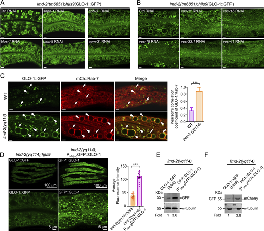 Engagement of BLOC-3, AP-3, HOPS, RAB-7, and GLO-1 in formation of abnormal LROs in lmd-2 mutants. (A) Representative images of LROs (labeled with GLO-1::GFP) in lmd-2(tm6851) mutants treated with RNAi to knock down BLOC-1 subunits (snpn-1, blos-1, and blos-8) and AP-3 subunits (apb-3 and apm-3). Scale bars, 5 μm. (B) Representative images of LROs (labeled with GLO-1::GFP) in lmd-2(tm6851) mutants treated with RNAi to knock down HOPS subunits. Scale bars, 5 μm. (C) Representative images (left) and quantification (right) of colocalization of GLO-1::GFP with mCh::RAB-7 in WT and lmd-2(yq114) mutants. Arrows indicate the vesicles with GLO-1::GFP and mCh::Rab-7 colocalization. Scale bars, 5 μm. 20 LROs were chosen to analyze the Pearson’s correlation coefficient of GLO-1/Rab-7 (mean ± SEM, n = 20 LROs, unpaired two-tailed t test, ***P < 0.001). (D) Left: Comparison of fluorescence intensity between GLO-1::GFP (hjIs9) and GFP::GLO-1(Pvha-6GFP::GLO-1) in lmd-2(yq114) mutants (top row), scale bars, 100 μm, and the rescue of enlarged LROs by GFP::GLO-1 in lmd-2(yq114) mutants (bottom row), scale bars, 5 μm. Right: Quantification of fluorescence intensity of GLO-1::GFP (hjIs9) and GFP::GLO-1(Pvha-6GFP::GLO-1) in lmd-2(yq114) mutants. Fluorescence intensity was measured in 15 animals for each group (mean ± SEM, n = 15 animals, unpaired two-tailed t test, ***P < 0.001). (E) Western blotting of GLO-1::GFP (hjIs9) and GFP::GLO-1(Pvha-6GFP::GLO-1) in lmd-2 mutants. (F) Western blotting of GLO-1::GFP (hjIs9) and mCh::GLO-1(Pvha-6mCh::GLO-1) in lmd-2 mutants. Total lysates from lmd-2(yq114); hjIs9 and lmd-2(yq114); Pvha-6mCh:: GLO-1 animals were resolved on the same membrane. The membrane was cut into halves and botted with GFP antibody and mCh antibody, respectively (top row). In E and F, protein levels were normalized to that of α-tubulin, and the fold change is indicated. Source data are available for this figure: SourceData FS3. Refer to the image caption for details.