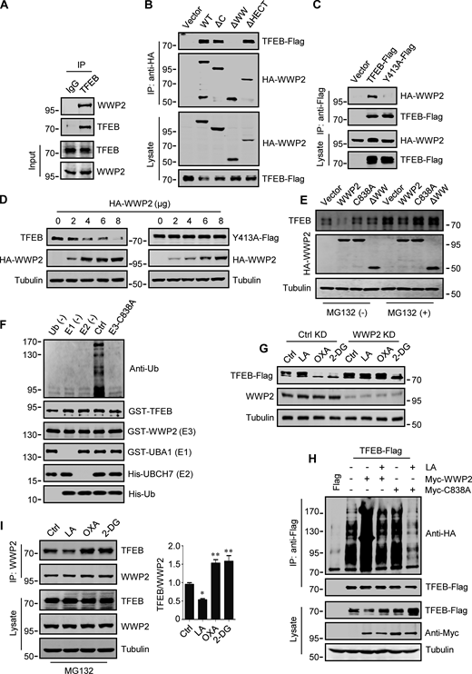 WWP2 mediates lactate-regulated TFEB ubiquitination and proteasomal degradation. (A) Coprecipitation of WWP2 with TFEB. TFEB immunoprecipitated (IP) from HeLa cells was blotted with anti-WWP2. IgG was used as a control for anti-TFEB. (B) Coprecipitation of TFEB-Flag with HA-WWP2. TFEB-Flag and HA-tagged WWP2 were cotransfected into HEK293 cells. After 24 h, HA-WWP2 was immunoprecipitated using anti-HA and analyzed by western blotting using anti-Flag. (C) Coprecipitation of HA-WWP2 with TFEB-Flag. HEK293 cells were transfected with HA-WWP2 and TFEB-Flag. After 24 h, TFEB-Flag was immunoprecipitated with anti-Flag and analyzed using anti-HA. (D) Effect of WWP2 expression on TFEB and TFEB-Y413A protein levels. Different amounts of HA-WWP2 plasmids were transfected into HeLa cells with or without TFEB-Y413A-Flag. After 24 h, the expression of endogenous TFEB in cells without TFEB-Y413A-Flag transfection and the transfected TFEB-Y413A-Flag were analyzed using anti-TFEB and anti-Flag, respectively. (E) TFEB levels in cells expressing WWP2 mutants. HeLa cells were transfected with HA-tagged WWP2. After 24 h, cells were treated with or without MG132 for 6 h and TFEB expression was analyzed. (F) In vitro ubiquitination assay of purified GST-TFEB. GST-TFEB was incubated with purified His-tagged ubiquitin (Ub) and UBA1 (E1) and GST-tagged UBCH7 (E2) and WWP2. The reactions were analyzed by western blotting using anti-ubiquitin. (G) Effect of WWP2 KD on TFEB expression. HEK293 cells with stable TFEB-Flag expression were cultured with control or WWP2 siRNA for 48 h, then treated as indicated, and TFEB-Flag expression were analyzed using anti-Flag. (H) Ubiquitination of TFEB-Flag in cells. HEK293 cells expressing HA-ubiquitin were transfected with TFEB-Flag and Myc-tagged WWP2. After 24 h, cells were treated with or without lactic acid (LA). Immunoprecipitated TFEB-Flag was blotted with anti-HA. (I) Effect of lactic acid on TFEB–WWP2 interaction. HeLa cells were treated as indicated in the presence of MG132. Immunoprecipitated WWP2 was blotted with anti-TFEB. The quantitative data of three independent experiments are presented as mean ± SEM. *P < 0.05, **P < 0.01. All molecular weights are in kD. Source data are available for this figure: SourceData F4.