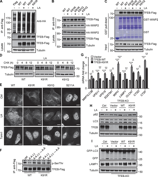 Lactylation prevents TFEB–WWP2 interaction and TFEB degradation. (A) Ubiquitination of TFEB-K91R in cells. HeLa cells expressing HA-ubiquitin were transfected with the indicated plasmids, then were treated with or without lactic acid (LA). (B) Co-immunoprecipitation (IP) of Flag-tagged TFEB-K91R and TFEB-K91Q with HA-WWP2 in co-transfected HeLa cells. Cells were treated with or without lactic acid 24 h after transfection. (C) In vitro pull-down assay of WWP2–TFEB binding. Purified GST-WWP2 beads were incubated with lysates of Flag-tagged TFEB-expressing HEK293 cells treated with or without lactic acid. GST-WWP2 bound TFEB-Flag was detected by western blotting using anti-Flag. (D) Degradation of TFEB-Flag in HeLa cells. Flag-tagged TFEB-WT or TFEB mutants were treated with lactic acid in the presence of CHX for the indicated time, then the proteins were detected by western blot using anti-Flag. (E) Distribution of TFEB. HEK293 cells transiently expressing Flag-tagged TFEB were treated with lactic acid or Torin1 and stained with anti-Flag. Scale bars, 5 μm. (F) Phosphorylation of TFEB. HEK293T cells transiently expressing TFEB-Flag or TFEB-K91R-Flag were cultured in amino acid-free medium for 4 h. After amino acid supplementation for 1 h, TFEB were immunoprecipitated and blotted with an antibody against phosphorylated serine/threonine. (G) Expression of TFEB target gene mRNA in HeLa cells expressing TFEB-Flag or TFEB-K91R-Flag. The Data are from three independent experiments and presented as mean ± SEM; *P < 0.05, **P < 0.01, ***P < 0.001. (H) Levels of p62 and LC3 in TFEB-KO HeLa cells transfected with TFEB-WT or TFEB-K91R. (I) Free GFP production and LAMP1 expression in TFEB-KO HeLa cells transfected with TFEB-WT or TFEB-K91R and GFP-LC3. Cells were treated with or without lactic acid. All molecular weights are in kD. Source data are available for this figure: SourceData F6.