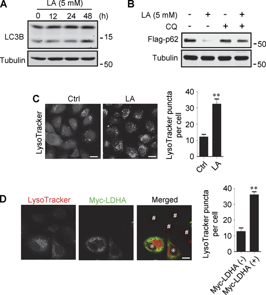 Lactate promotes autophagy and lysosome biogenesis. (A) Western blot analysis of LC3B expression in PANC cells treated with 5 mM lactic acid (LA) for the indicated time duration. (B) Flag-p62 levels in transiently transfected PANC cells treated with 5 mM lactic acid with or without CQ for 24 h. (C) Representative LysoTracker staining of HeLa cells after lactic acid treatment. The quantitative data are from 60 cells of three independent experiments and presented as mean ± SEM; **P < 0.01. (D) Representative LysoTracker staining of HeLa cells transfected with LDHA. The quantitative data are from 30 cells of three independent experiments and presented as mean ± SEM; **P < 0.01. Cells with LDHA expression are indicated with * while cells that do not express LDHA are indicated with #. **P < 0.01. All molecular weights are in kD. Scale bars: 20 μm in C, 10 μm in D. Source data are available for this figure: SourceData FS1.