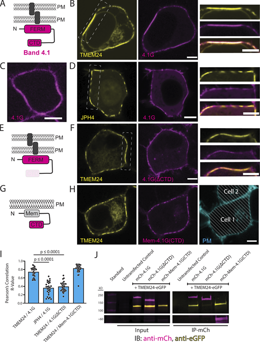 Band 4.1 proteins bind TMEM24 via an interaction between a TMEM24 β-sheet motif and the C-terminal domain of Band 4.1. (A) Diagram of Band 4.1 family proteins (a cell adhesion protein is indicated by a gray rectangle). (B) Confocal images of HEK293 cells expressing TMEM24-eGFP and mCherry-4.1G. High magnification of the boxed region are shown at right. Representative example of n = 34 cells. (C) mCherry-4.1G expressed in a HEK293 cell accumulates at the plasma membrane with enrichment at regions adjacent to a neighboring cell. (D) Co-expression of JPH4-eGFP and mCherry-4.1G in HEK293 cells result in no co-enrichment at the ER/PM contact. Representative example of n = 27 cells. (E) Diagram of 4.1G(ΔCTD) with cell adhesion molecule as gray rectangle. (F) Confocal images of HEK293 cells expressing TMEM24-eGFP and mCherry-4.1G(ΔCTD). High magnification of the boxed region are shown at right. Representative example of n = 31 cells. (G) Diagram of the Mem-mCherry-4.1G(CTD) construct. (H) Confocal images of the corresponding construct co-expressed with TMEM24 in HEK293 cells. The two proteins are colocalized at ER/PM junctions, but the strong accumulation of TMEM24 at sites of cell–cell contacts is no longer observed. The panel at right shows the location of a neighboring cells stained with CellBrite 650. Representative example of n = 33 cells. (I) Pearson’s correlation analysis of the colocalization of the indicated constructs. TMEM24 and 4.1G are significantly more colocalized (Robs = 0.74) than JPH4 and 4.1G (Robs = 0.36; P = 1.96443E-14) and TMEM24 and 4.1G(ΔCTD) (Robs = 0.39; P = 1.75766E-19). TMEM24 and Mem-4.1G(CTD) also display high colocalization with one another (Robs = 0.82). (J) Anti-mCherry immunopurification from extracts expressing TMEM24-eGFP with mCherry-4.1G, mCherry-4.1G(ΔCTD) or mCherry-Mem-4.1G(CTD) showing co-enrichment of TMEM24-eGFP with mCherry-4.1G and mCherry-Mem-4.1(CTD) but not with mCherry-4.1(ΔCTD). Source data are available for this figure: SourceData F5.