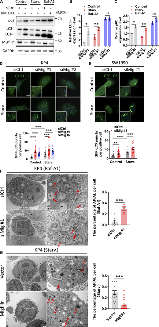 Migfilin depletion promotes autophagosome accumulation. (A) Immunoblotting analysis of p62 and LC3 levels in control (siCtrl) and migfilin knockdown (siMig #1). KP4 cells under nutrient-rich (control), EBSS starvation (Starv.), or bafilomycin A1 (Baf-A1, 1 μM) treatment condition. (B and C) Quantification analysis of LC3-II (B) and p62 (C) levels in A. Data represent mean ± SE, *P < 0.05, **P < 0.01. n.s., no significance, unpaired two-tailed t test. n = 3 independent experiments. (D) KP4 cells were stably transfected with GFP-LC3 (green) under control or EBSS starvation conditions and imaged by fluorescence microscopy. The number of GFP-LC3 puncta was measured. Representative images were shown in the upper panel and quantification analysis was shown in the lower panel. Scale bar: 10 µm (Magnify: 2 µm). At least 30 images in each group were analyzed. Data represent mean ± SE, ***P < 0.001, one-way ANOVA. n = 3 independent experiments. (E) SW1990 cells were stably transfected with GFP-LC3 (green) under control or EBSS starvation condition and imaged by fluorescence microscopy. The number of GFP-LC3 puncta was measured. Scale bar: 10 µm (Magnify: 2 µm). Representative images were shown in the upper panel and quantification analysis was shown in the lower panel. At least 30 images in each group were analyzed. Data represent mean ± SE, **P < 0.01, ***P < 0.001, unpaired two-tailed t test. n = 3 independent experiments. (F) Transmission electron microscopy (TEM) analysis of autophagosomes (AP, solid arrows) and autolysosomes (AL, open arrows) in control (siCtrl) or migfilin knockdown (siMig #1) KP4 cells with 1 μM Baf-A1 treatment. Higher magnification of TEM images was shown. Scale bar: 2 µm (left panel), 0.5 µm (right panel). Quantification analysis was shown in the right panel. Data represent mean ± SE, ***P < 0.001, unpaired two-tailed t test. n = 6 independent experiments. (G) TEM analysis of autophagosomes (solid arrows) and autolysosomes (open arrows) in control (vector) or migfilin overexpressed (Migfilin) KP4 cells under EBSS starvation condition. Higher magnification was shown. Scale bar: 2 µm (left panel), 0.5 µm (right panel). Quantification analysis is shown in the right panel. Data represent mean ± SE, ***P < 0.001, unpaired two-tailed t test. n = 15 independent experiments. Source data are available for this figure: SourceData F1. Refer to the image caption for details.