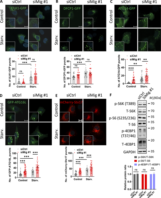 Depletion of migfilin does not affect autophagy initiation. (A) KP4 cells were transfected with ULK1-GFP. Representative images of ULK1-GFP puncta were shown in control (siCtrl) or migfilin knockdown (siMig #1) KP4 cells under both control and starvation conditions. Scale bar, 10 µm (Magnify, 2 µm). Quantification of the number of ULK1-GFP puncta was shown in the lower panel. Data represent mean ± SE, ***P < 0.001, n.s., no significance, unpaired two-tailed t test. n = 3 independent experiments with at least 40 cells for each group. (B) KP4 cells were stably transfected with DFCP1-GFP. Representative images of DFCP1-GFP puncta were shown. Scale bar, 10 µm (Magnify, 2 µm). Quantification of the number of DFCP1-GFP puncta was shown in the lower panel. Data represent mean ± SE, ***P < 0.001, n.s., no significance, unpaired two-tailed t test. n = 3 independent experiments with at least 30 cells for each group. (C) KP4 cells were stably transfected with ATG14-GFP. Representative images of ATG14-GFP puncta were shown. Scale bar, 10 µm (Magnify, 2 µm). Quantification of the number of ATG14-GFP puncta was shown in the lower panel. Data represent mean ± SE, **P < 0.01, ***P < 0.001, unpaired two-tailed t test. n = 3 independent experiments with at least 34 cells for each group. (D) KP4 cells were stably transfected with GFP-ATG16L. Representative images of GFP-ATG16L puncta were shown. Scale bar, 10 µm (Magnify, 2 µm). Quantification of the number of GFP-ATG16L puncta was shown in the lower panel. Data represent mean ± SE, ***P < 0.001, unpaired two-tailed t test. n = 3 independent experiments with at least 28 cells for each group. (E) KP4 cells were stably transfected with mCherry-Stx17. Representative images of mCherry-Stx17 puncta were shown. Scale bar, 10 µm (Magnify, 2 µm). Quantification of the number of mCherry-Stx17 puncta was shown in the lower panel. Data represent mean ± SE, ***P < 0.001, unpaired two-tailed t test. n = 3 independent experiments with at least 33 cells for each group. (F) Immunoblotting analysis of the protein expression level of total S6K (T-S6K), phosphorylated (p)-S6K, total S6 (T-S6), phosphorylated (p)-S6, total 4EBP1 (T-4EBP1), phosphorylated (p)-4EBP1 in control (siCtrl) and migfilin knockdown (siMig #1) KP4 cells under control condition. Quantification analysis of the ratios of p-S6K/T-S6K, p-S6/T-S6, and p-4EBP1/T-4EBP1 was shown in the lower panel. Data represent mean ± SE, n.s., no significance, unpaired two-tailed t test. n = 6 independent experiments. Source data are available for this figure: SourceData F6.