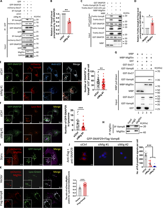 Migfilin promotes SNAP29-Vamp8 complex assembly. (A) Control or migfilin knockdown cells were coexpressed 3×Flag-tagged Vamp8, mCherry-Stx17, and GFP-SNAP29 or GFP alone. Cell lysates were extracted and used for immunoprecipitation with anti-GFP nanobeads. Immunoprecipitants were then analyzed by immunoblotting with antibodies as indicated. The presence of 3×Flag-tagged Vamp8, mCherry-Stx17, and GFP-SNAP29 or GFP in cell lysates was shown as input. (B) Quantification of the level of 3 × Flag-tagged Vamp8 precipitated by GFP-SNAP29. Data represent mean ± SE, **P < 0.01, unpaired two-tailed t test. n = 4 independent experiments. (C) Purified GST-tagged SNAP29 was used to pull down purified TrxHis-Vamp8 (8–73 aa) and TrxHis-Stx17 (142–225 aa) with or without purified MBP-tagged migfilin. The eluted proteins were analyzed by immunoblotting with the indicated antibodies. (D) Quantification of the level of TrxHis-Vamp8 (8–73 aa) precipitated by GST-SNAP29. Data represent mean ± SE, *P < 0.05, unpaired two-tailed t test. n = 3 independent experiments. (E) Control or migfilin knockdown cells were stably coexpressed GFP-SNAP29 and mCherry-Vamp8. Representative images showed that less GFP-SNAP29+ puncta colocalized with mCherry-Vamp8+LC3+ puncta in migfilin knockdown cells under starvation conditions. Scale bar, 10 µm (Magnify, 1 µm). Quantification of the percentage of GFP-SNAP29+ puncta to mCherry-Vamp8+LC3+ puncta was shown in the right panel. Data represent mean ± SE, **P < 0.01, unpaired two-tailed t test. n = 3 independent experiments with >37 cells for each group. (F) Control or migfilin knockdown cells were stably overexpressed with GFP-SNAP29. Representative images showed that less GFP-SNAP29+ puncta co-localized with lysosomes labeled with lysotracker red (Lyso-Red) in migfilin knockdown cells under starvation condition. Scale bar, 10 µm (Magnify, 2 µm). Quantification of the percentage of the GFP-SNAP29+ puncta colocalizing with lysotracker red labeled-lysosomes was shown in the right panel. Data represent mean ± SE, ***P < 0.001, unpaired two-tailed t test. n = 3 independent experiments with >22 cells for each group. (G) Direct interaction between migfilin and Vamp8. Purified MBP or MBP-tagged migfilin was used to pull down GST alone, GST-tagged Vamp8, or GST-tagged Stx17. The eluted proteins were analyzed by immunoblotting with the indicated antibodies. (H) KP4 were coexpressed 3 × Flag-tagged Vamp8 (3F-Vamp8). Cell lysates were IPed with anti-migfilin antibody or control IgG (mIgG) followed by immunoblotting with antibodies as indicated. The presence of target proteins in cell lysates was shown as input. (I) KP4 cells were co-expressed with GFP-Vamp8 and mCherry-Migfilin. The representative images showed that mCherry-Migfilin co-localized with GFP-Vamp8. Scale bar, 5 µm (Magnify, 2 µm). (J) KP4 cells were coexpressed with GFP-SNAP29 and 3 × Flag-tagged Vamp8. Representative images of in situ PLA analyses of SNAP29-Vamp8 interaction (red dots). Cell nuclei were visualized with DAPI (blue). Scale bar, 10 µm. Quantification of PLA puncta per cell was shown in the right panel. Data represent mean ± SE, ***P < 0.001, one-way ANOVA. n = 3 independent experiments. (K) The co-localization ratio of mCherry-Migfilin with Lysotracker Green (Lyso-Green) in KP4 cells transfected with empty vector (vector) or 3 × Flag-tagged Vamp8 (Flag-Vamp8) was analyzed. Representative images were shown in the left panel and quantification analysis was shown in the right panel. Scale bar: 10 µm (Magnify: 2 µm). At least 19 cells in each group were analyzed. Data represent mean ± SE, ***P < 0.001, unpaired two-tailed t test. n = 3 independent experiments. Source data are available for this figure: SourceData F8.