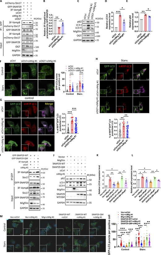 SNARE complex reassembly rescues migfilin deficiency–induced autophagic defects. (A) Cell lysates (as specified in the figure) were extracted and used for immunoprecipitation with anti-GFP nano-beads. Immunoprecipitants were then analyzed by immunoblotting with antibodies as indicated. The presence of 3×Flag-tagged Vamp8, mCherry-Stx17, and GFP-SNAP29 in cell lysates was shown as input. (B) Quantification of the level of 3 × Flag-tagged Vamp8 precipitated by GFP-SNAP29. Data represent mean ± SE, *P < 0.05, **P < 0.01, one-way ANOVA. n = 3 independent experiments. (C) Immunoblotting analysis of LC3 and p62 protein levels in cells as indicated in the figure. (D and E) Quantification of LC3-II (D) and p62 (E) levels was shown. Data represent mean ± SE, *P < 0.05, **P < 0.01, ***P < 0.001, one-way ANOVA. n = 4 independent experiments for each group. (F) KP4 cells were stably expressed with GFP-LC3. The number of GFP-LC3 puncta was measured. Representative images are shown in the left panel and quantification analysis is shown in the right panel. Scale bar: 5 µm (Magnify, 2 µm). At least 22 cells in each group were analyzed. Data represent mean ± SE, ***P < 0.001, one-way ANOVA. n = 3 independent experiments. (G and H) KP4 cells were stably expressed with mRFP-GFP-LC3 reporter. Representative images of mRFP-LC3 puncta and GFP-LC3 puncta in cells as specified in the figure under control (G) or starvation (H) condition were shown. Quantification of the percentage of RFP+GFP+ puncta to total puncta was determined. Scale bar, 10 µm (Magnify, 2 µm). Data represent mean ± SE, **P < 0.01, ***P < 0.001, one-way ANOVA. n = 3 independent experiments. At least 20 cells in each experiment were analyzed. (I) Cell lysates (as specified in the figure) were extracted and used for immunoprecipitation with anti-GFP nano-beads. Immunoprecipitants were then analyzed by immunoblotting with antibodies as indicated. The presence of 3×Flag-tagged Vamp8, Stx17 and GFP-SNAP29-WT or GFP-SNAP29-QM in cell lysates was shown as input. (J) Immunoblotting analysis of LC3 and p62 protein levels in cells as indicated in the figure. (K and L) Quantification of LC3-II (K) and p62 (L) levels was shown. Data represent mean ± SE, *P < 0.05, **P < 0.01, one-way ANOVA. n = 4 independent experiments for each group. (M) KP4 cells (as specified in the figure) were stably expressed with GFP-LC3. The number of GFP-LC3 puncta was measured. Representative images were shown in the left panel and quantification analysis was shown in the right panel. Scale bar: 10 µm (Magnify, 2 µm). At least 30 cells in each group were analyzed. Data represent mean ± SE, **P < 0.01, ***P < 0.001, one-way ANOVA. n = 3 independent experiments. Source data are available for this figure: SourceData F9. Refer to the image caption for details.