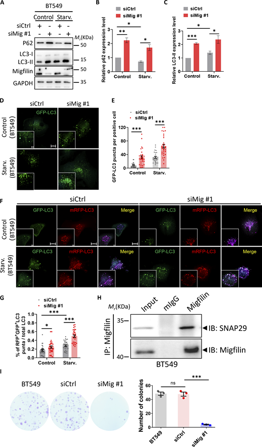 Migfilin depletion blocks autophagic flux and inhibits cell growth in human breast cancer cells. (A) Immunoblotting analysis of p62 and LC3 levels in control (siCtrl) and migfilin knockdown (siMig #1) BT549 cells under nutrient-rich (control), EBSS starvation (Starv.) condition. (B and C) Quantification analysis of p62 (B) and LC3-II (C) levels in A. Data represent mean ± SE, *P < 0.05, **P < 0.01, ***P < 0.001, unpaired two-tailed t test. n = 4 independent experiments. (D and E) BT549 cells were stably transfected with GFP-LC3 (green) under control or EBSS starvation condition and imaged by fluorescence microscopy. The number of GFP-LC3 puncta was measured. Representative images were shown in D and quantification analysis was shown in E. Scale bar: 10 µm (Magnify: 2 µm). At least 26 cells in each group were analyzed. Data represent mean ± SE, ***P < 0.001, unpaired two-tailed t test. n = 3 independent experiments. (F) BT549 cells were stably transfected with mRFP-GFP-LC3 report system. Representative images of mRFP-LC3 puncta and GFP-LC3 puncta in control (siCtrl) or migfilin knockdown (siMig #1) BT549 cells under control and starvation conditions. Scale bar, 10 µm (Magnify, 2 µm). (G) Quantification of the percentage of RFP+GFP+ puncta to total puncta in F was shown. Data represent mean ± SE, *P < 0.05, ***P < 0.001, unpaired two-tailed t test. n = 3 independent experiments. At least 30 cells in each experiment were analyzed. (H) BT549 cell lysates were immunoprecipitated (IPed) with anti-migfilin antibody or control IgG (mIgG) followed by immunoblotting with antibodies as indicated. The presence of target proteins in cell lysates was shown as input. (I) Depletion of migfilin in BT549 cells led to a significant decrease in anchorage-dependent colony-forming abilities. Representative images (left panel) and quantification analysis (right panel) were shown. Data represent mean ± SE, ***P < 0.001, n.s., no significance, one-way ANOVA, n = 3 independent experiments. Source data are available for this figure: SourceData FS2.