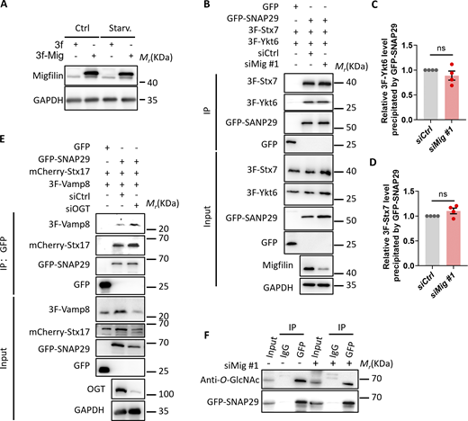 Migfilin does not regulate Stx7-SNAP29-Ykt6 complex assembly and SNAP29 O-GlcNAcylation. (A) KP4 cells were successfully overexpressed with migfilin. KP4 cells were overexpressed 3 × Flag(3f)-tagged migfilin. Immunoblotting analysis of migfilin levels in control (3f) and migfilin overexpressed (3f-Mig) KP4 cells under nutrient-rich (control), EBSS starvation (Starv.) condition. (B–D) Migfilin does not promote Stx7–SNAP29–Ykt6 complex assembly. (B) Control or migfilin knockdown cells were coexpressed 3 × Flag-tagged Stx7 (3F-Stx7), 3 × Flag-tagged Ykt6 (3F-Ykt6), and GFP-SNAP29 or GFP alone. Cell lysates were extracted and used for immunoprecipitation with anti-GFP nanobeads. Immunoprecipitants were then analyzed by immunoblotting with antibodies as indicated. The presence of 3 × Flag-tagged Stx7 and Ykt6, and GFP-SNAP29 or GFP in cell lysates was shown as input. Quantification of the level of 3 × Flag-tagged Ykt6 (C) or 3 × Flag-tagged Stx7 (D) precipitated by GFP-SNAP29 was shown. Data represent mean ± SE, n.s., no significance, unpaired two-tailed t test. n = 4 independent experiments. (E) OGT silencing promotes SNARE complex formation. Cell lysates (as specified in the figure) were extracted and used for immunoprecipitation with anti-GFP nanobeads. Immunoprecipitants were then analyzed by immunoblotting with antibodies as indicated. The presence of 3 × Flag(3F)-tagged Vamp8, mCherry-Stx17, and GFP-SNAP29 or GFP in cell lysates was shown as input. (F) Depletion of migfilin does not increase SNAP29 O-GlcNAcylation. Control or migfilin knockdown cells (siMig #1) was overexpressed GFP-SNAP29. Cell lysates were immunoprecipitated (IPed) with anti-GFP nanobeads or control IgG (IgG) followed by immunoblotting with antibodies as indicated. The presence of target proteins in cell lysates was shown as input. Source data are available for this figure: SourceData FS4.