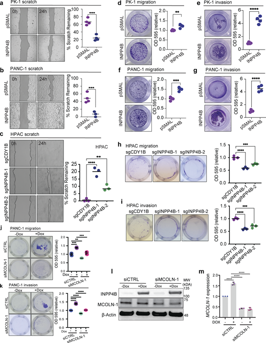 INPP4B affects PDAC cell migration and invasion. (a–i) Depicted are cells with stable overexpression of empty control (pSMAL) or INPP4B (pSMAL-INPP4B) in INPP4Blow (a, d, and e) PK-1 or (b, f, and g) PANC-1 cells, or INPP4B KO with the indicated gRNAs in c, h, and i INPP4Bhigh HPAC cell lines. Respective cell models were tested for wound healing (a–c), transwell migration (d, f, and h), and transwell invasion (e, g, and i) assays. (j–m)pCW-INPP4B PANC-1 treated with siCTRL or siMCOLN-1 and no Dox or 500 nM Dox and assessed for transwell migration (j), transwell invasion (k), protein levels of MCOLN-1 (l), and transcripts of MCOLN-1 gene expression (m). Data represent ± SD from three independent experiments, with unpaired two-tailed parametric t test performed for a, b, and d–g, and one-way ANOVA Tukey’s post hoc test for c and h–m. **P < 0.01, ***P < 0.001, ****P < 0.0001. Source data are available for this figure: SourceData F7. Refer to the image caption for details.