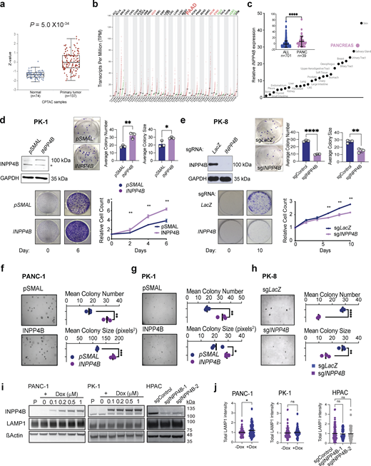 Effect of INPP4B expression on PDAC cell growth. (a) Differential analysis of INPP4B protein expression in normal and primary PDAC were assessed using Clinical Proteome Tumor Analysis Consortium (CPTAC) data accessed from the UALCAN data portal. (b) Dot blot of INPP4B transcript expression of INPP4B in normal (N) and tumor specimens (T) across 33 TCGA tumor samples and paired normal tissues. (c) Ranked means and total mean (inset) of INPP4B expression in PDAC cell lines compared to all other cancer cell lines in the Cancer Cell Line Encyclopedia. (d and e) Images representing cells with stable overexpression of INPP4B in INPP4Blow (d) PK-1 or INPP4B KO in (e) INPP4Bhigh PK8 cell lines. Cells were tested for INPP4B protein expression by IB (top left panels). Representative images of crystal violet–stained colonies and quantitation of average colony number and average colony size in clonogenic assay, with respective empty controls for PK-1 cells (d) or control CRISPR-Cas9 KO in (e) PK8 cells 19 days after seeding. Proliferation assays (bottom left images) and representative crystal violet–stained wells (bottom right graph) at day 0 and on the final day of the proliferation assay along with crystal violet quantification for the indicated days for PK-1 (d) and PK8 (e) cells. (f–h) Anchorage-independent growth capacity in soft agar (representative images, left images) was quantitated (right graphs) for empty control or INPP4B overexpressing PANC-1 (f) and PK-1 (g) cells, control or INPP4B CRISPR-Cas9 KO for PK8 (h) cells. (i)pCW-INPP4B PANC-1 and PK-1 cells were treated with Dox at the indicated concentrations, and HPAC cells stably expressing indicated sgRNAs were immunoblotted for INPP4B, LAMP1, and actin. (j) Quantitation of total LAMP1 intensity per cell for indicated cell lines and treatments. Data are representative of ± SD from three individual experiments for d–h, with 100–120 cells counted per treatment per condition for j, with unpaired two-tailed parametric t test performed for c, and colony formation assays for d, e, f–h, and j, one-way ANOVA Tukey’s post hoc test for j, and two-way ANOVA and multiple unpaired t tests for growth curve assays for d and e. *P < 0.05, **P < 0.01, ***P < 0.001, ****P < 0.0001. Source data are available for this figure: SourceData FS1.