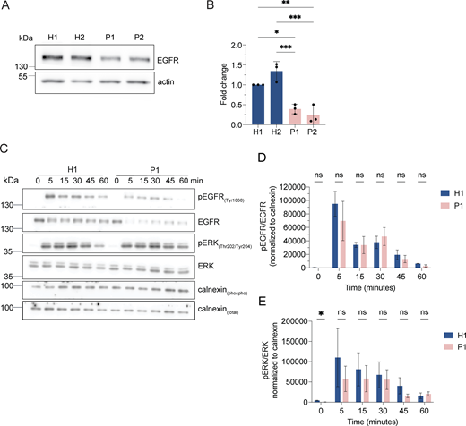 LRBA does not regulate EGFR signaling attenuation. (A) EGFR protein levels are reduced in LRBA-deficient fibroblasts. Immunoblot analysis of EGFR in two healthy and two LRBA-deficient patient-derived fibroblast lines. Actin was used as a loading control. The same blot has been re-probed with LRBA antibody and is shown in Fig. 1 C, therefore the loading control (actin) is identical on the two images. (B) Quantification of EGFR levels based on immunoblots shown on panel A from n = 3 biological replicates; one-way ANOVA using Tukey’s multiple comparison; *P = 0.0124, **P = 0.0034, ***P = 0.0008 (H2 versus P1), ***P = 0.0003 (H2 versus P2). (C) Immunoblot analysis of EGFR signaling kinetics in H1 and P1 fibroblasts. Cells were serum-starved overnight in DMEM and then incubated with 2 μg/ml EGF in serum-free DMEM for the indicated time points. Cells were then rinsed with ice-cold PBS and lysed with M-PER lysis buffer supplemented with protease and phosphatase inhibitors. For addressing EGFR signaling, an antibody against EGFR and its phosphorylation site Tyr1068 was used. We also detected the downstream ERK phosphorylation with the Thr202/Tyr204 phosphorylation sites specific antibody. Calnexin was used as loading control. (D) Quantification of pEGFR levels and kinetics upon EGF stimulation based on immunoblots shown in A. pEGFR and EGFR levels were measured and normalized to calnexin loading controls (pEGFRnorm, EGFRnorm). Then pEGFRnorm values were normalized to EGFRnorm values and plotted over time. Two-way ANOVA using Šidák’s multiple comparisons test. (E) Quantification of pERK levels and kinetics upon EGF stimulation based on immunoblots as shown in A. pERK and total ERK levels were measured and normalized to calnexin loading controls (pERKnorm, ERKnorm). Then pERKnorm values were normalized to ERKnorm values and plotted over time. Two-way ANOVA using Šidák’s multiple comparisons test. *P = 0.0448. Source data are available for this figure: SourceData FS3.