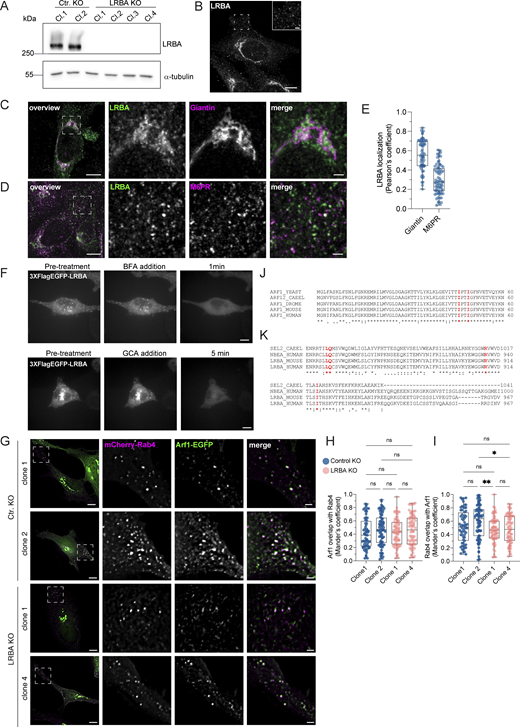 LRBA is endogenously expressed in HeLa cells and recruited to endosomes by Arfs. (A) Immunoblot analysis of LRBA presence in HeLa cells of two control and four LRBA KO clones using polyclonal LRBA antibody and α-tubulin as a loading control. (B) LRBA is localized at the perinuclear region and on vesicular structures in HeLa cells. Immunofluorescence analysis of endogenous LRBA in fixed HeLa cells. Scale bar, 10 μm, inlay 2 μm. (C) LRBA partly colocalizes with the cis-Golgi in HeLa cells. Immunofluorescence staining of endogenous LRBA and the cis-Golgi marker giantin in fixed HeLa cells. Squares show magnification of the perinuclear area. The labeling of the single channels represents the color of the channel on the merged image. Scale bar, 10 μm, inlays 2 μm. (D) LRBA does not colocalize with M6PR in HeLa cells. Immunofluorescence analysis of endogenous LRBA and endogenous M6PR colocalization in fixed HeLa cells. Squares show magnification of the perinuclear area. The labeling of the single channels represents the color of the channel on the merged image. Scale bar, 10 μm, inlays 2 μm. (E) Colocalization measurement of LRBA with giantin and M6PR. To measure LRBA colocalization with giantin one ROI at the perinuclear region was analyzed. To measure colocalization with M6PR, two ROIs per cell at the cell periphery were analyzed and the Pearson’s coefficient was measured using the JACoP plugin in Fiji. Mean and minimum to maximum are shown, box ranges from the first (Q1–25th percentiles) to the third quartile (Q3–75th percentiles) of the distribution. All data points are shown. Giantin = 60 cells, M6PR = 35 cells. (F) LRBA puncta disperse upon treatment with ArfGEF inhibitors. Live-cell imaging of 3xFlagEGFP-LRBA upon BFA (top panels) and GCA (lower panels) treatment for indicated timepoints. Scale bar, 10 μm. (G) Arf1 is recruited onto Rab4+ endosomes in the absence of LRBA. Control KO and LRBA KO HeLa cells were transfected with mCherry-Rab4 and Arf1-EGFP and cells were imaged live using a wide-field microscope at 37°C, 5% CO2 atmosphere. Deconvolved images of single stacks are shown. Squares show magnification of the perinuclear area. The labeling of the single channels represents the color of the channel on the merged image. Scale bar, 10 μm, inlays 2 μm. (H and I) Colocalization measurement of Arf1-EGFP and mCherry-Rab4 in control and LRBA KO HeLa cells. Two ROIs per cell were analyzed and Mander’s coefficients were measured using the JACoP plugin in Fiji. Arf1 overlap with Rab4 (M1) is shown in H, Rab4 overlap with Arf1 (M2) is shown in I. All data points are shown. Ctr. KO clone1 = 32 cells, Ctr. KO clone2 = 39 cells, LRBA KO clone1 = 36 cells, LRBA KO clone 4 = 36 cells from n = 3 biological replicates; (H) one-way ANOVA using Tukey’s multiple comparison. (I) Kruskal–Wallis test using Dunn’s multiple comparisons test, **P = 0.0071, *P = 0.0201. (J) The amino acids isoleucine 46 and 49 of Arf1 and Arf3 were predicted to interact with LRBA. Both amino acids are conserved across species. The amino acid sequences of the yeast, C. elegans (CAEEL), Drosophila melanogaster (DROME), mouse and human Arf1 and human Arf3 were aligned. Labels: (*) conserved sequence; (:) conservative mutation; (.) semiconservative mutation; (−) gap. Sequence alignments were performed using Clustal Omega. (K) The amino acids leucine 861, arginine 910, and isoleucine 918 of LRBA were predicted to interact with Arf1 and Arf3. All three amino acids are conserved across species. The amino acid sequences of the C. elegans SEL-2 (SEL2-CAEEL), the mouse and the human LRBA, and the human neurobeachin (NBEA) were aligned. Labels: (*) conserved sequence; (:) conservative mutation; (.) semi-conservative mutation; (-) gap. Sequence alignments were performed using Clustal Omega. Source data are available for this figure: SourceData FS5.