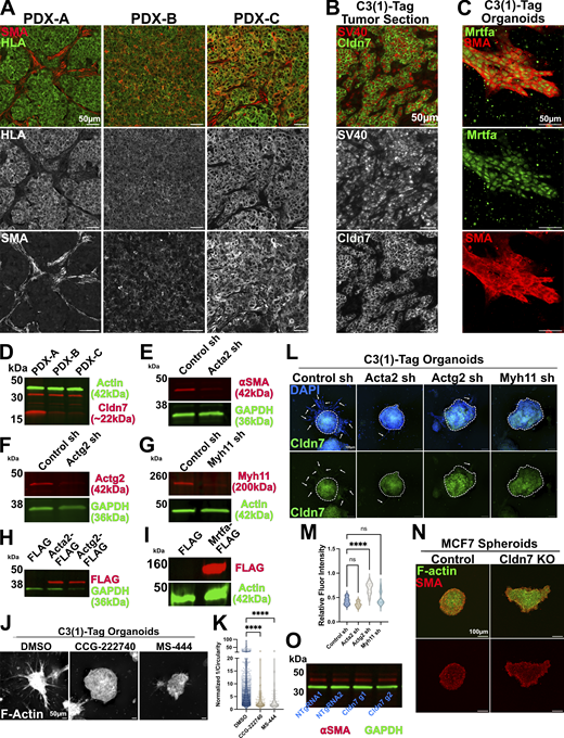 Expression and genetic perturbation of SMA-related genes. (A) Representative images of tumor tissue sections obtained from PDX tumors. Tumor sections were stained with antibodies that recognize HLA to identify cancer cells and antibodies for SMA/Acta2. PDX-A = TM00098, PDX-B = TM00096, PDX-C = TM00089. (B) Representative images of a tumor section from the C3(1)-Tag GEMM of breast cancer that was stained with antibodies that recognize SV40 to identify cancer cells and antibodies for Cldn7. (C) Representative image of an invasive organoid from the C3(1)-Tag GEMM of breast cancer stained for the myocardin-related transcription factor a (Mrtfa) and αSMA. (D) Western blot of protein lysates isolated from PDX-derived organoids. (E–G) Western blot of organoids derived from C3(1)-Tag organoids transduced with Control shRNA, Acta2 targeting shRNA (E), Actg2 targeting shRNA (F), and Myh11 targeting shRNA (G). (H) Western blot of protein lysates isolated from MMTV-Neu organoids expressing control (FLAG), Acta2-FLAG, and Actg2-FLAG constructs. (I) Western blot of protein lysates isolated from MMTV-Neu organoids expressing control (FLAG) or Mrtfa-FLAG constructs. (J) Representative images of organoids derived from the C3(1)-Tag GEMM of breast cancer and treated with the indicated inhibitors at a concentration of 33 µM. Organoids were stained for F-actin (phalloidin). (K) Inverse circularity (1/circularity) quantification of organoids treated with SMA inhibitors. DMSO n = 942, r = 2; CCG-222740 n = 138, r = 2; MS-444, n = 94, r = 2. Ordinary one-way ANOVA was used to determine significance **** = P < 0.0001. (L) Representative images of C3(1)-Tag derived organoids expressing Control (non-targeting) shRNA, or shRNA targeting Acta2, Actg2, or Myh11. These organoids were immunostained for Cldn7. Core of organoids outlined with dashed line. Arrows indicate invasive cells. (M) Quantification of Cldn7 immunofluorescence intensity relative to DAPI fluorescence intensity in organoids from L. For all conditions n = 10. Ordinary one-way ANOVA was used to determine significance **** = P < 0.0001. (N) Representative images of control and CLDN7 knockout (KO) spheroids derive from MCF7 cells. Spheroids were immunostained for SMA and stained with phalloidin (F-actin). (O) Western blot of protein lysate from control and CLDN7 KO MCF7 cell lines. Membranes were probed with ⍺SMA and GAPDH. Source data are available for this figure: SourceData FS3.