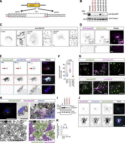 Sec23IP KO results in Golgi fragmentation phenocopying the VPS13B KO in HeLa. (A) CRISPR knock-out of Sec23IP in HeLa cells (Sec23IP-KO). Two sgRNAs are used, indicating the PAMs (GGG for sgRNA1 and sgRNA2) for spCas9. (B) Western blots of six Sec23IP-KO clones in A. Sec23IP-KO clone-1 and -2 were used in the study. (C) Representative images of fixed control or two Sec23IP-KO clones as in B stained with anti-GM130 with two insets on the right. (D) Representative images of a live HeLa cell expressing GFP-Sec23IP (magenta) and MGAT2-Halo (green) with an inset on the bottom. (E) Representative images of fixed HeLa cells expressing Halo-Sec23IP (green) stained with GM130 antibody (blue) and Sec31A antibody (magenta) with two insets at the bottom. Red arrows indicated a cell with the expression of Halo-Sec23IP while blue arrows denoted a cell without Halo-Sec23IP expression. (F) Percentage of Sec31A puncta associated with the Golgi in either control (12 cells), WT cells expressing Halo-Sec23IP (10 cells), or VPS13B KO-1 cells expressing Halo-Sec23IP (12 cells) from three independent experiments. Ordinary one-way ANOVA with Tukey’s multiple comparisons test. Mean ± SD. (G) Top: representative images of Sec23IP KO HeLa cell transiently expressing VPS13B^sfGFP (magenta) and stained for Sec31A (green) with two insets on the right. Bottom: representative images of VPS13B KO HeLa cell transiently expressing Halo-Sec23IP (green) and stained for GM130 (magenta) with two insets on the right. (H) HeLa cells expressing VPS13B^sfGFP, Halo-Sec23IP, and stained by DAPI, were fixed and imaged by 3D microscopy (top left panel) and processed for TEM. Fluorescence and TEM images were correlated (top middle panel) with insets showing associations between the cis-medial Golgi marked by VPS13B^sfGFP (green) and ERES labeled by Halo-Sec23IP (magenta). (I) Western blots showing the efficiency of siRNA-mediated Sec23IP depletion in VPS13B KO HeLa cells. (J) Representative images of a live HeLa cell transiently expressing GFP-VPS13B-VAB (green), Halo-Sec23IP (magenta), and mCh-Sec23A (blue) with an inset on the bottom. (K) Pearson’s correlation coefficient of Halo-Sec23IP versus mCh-Sec23A as shown in D in the absence (10 cells) or presence of GFP-VPS13B-VAB (9 cells) in three independent experiments. Mean ± SD. Two tailed unpaired Student’s t test. Scale bar, 10 μm in whole and 2 μm in insets in C–E, G, and J, and 0.2 μm in the insets in H. Source data are available for this figure: SourceData FS4.