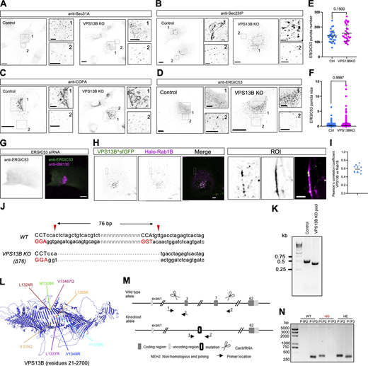 Supplementary data toFig. 5. (A–D) Representative images of fixed control (left panel) or VPS13B KO (right panel) HeLa cells stained with antibodies against Sec31A (A), Sec23IP (B), COPA (C), and ERGIC53 (D) with two insets to the right. (E and F) The number (E) and length (F) of ERGIC53 as in D. More than 20 cells were quantified for each condition from three independent experiments. Mean ± SD. Two-tailed unpaired Student’s t test. (G) Representative images of ERGIC53 siRNA-treated HeLa cells stained with antibodies against ERGIC53 (green) and GM130 (magenta). (H) Representative images of live HeLa cells transiently expressing VPS13B^sfGFP (green) and Halo-Rab1B (magenta) with an inset on the right. (I) Pearson’s correlation coefficient of VPS13B^sfGFP versus Halo-Rab1B as shown in (H; n = 11). (J) CRISPR knock-out of VPS13B in HEK293 cells. Two sgRNAs are used, indicating the PAMs (GGA for sgRNA1 and GGT for sgRNA2) for spCas9. (K) DNA gel of a VPS13B-KO HEK293 pool in A. (L) AlphaFold predicted structures of a VPS13B lipid transfer-defective mutant (VPS13B-LTPmut^GFP) with mutated hydrophobic residues in the midway of the hydrophobic groove. (M) Strategy for generation of VPS13B KO C57BL/6J mouse strain by CRISPR-Cas9, in which 51,822 bp between exon 1 and exon 7 of the VPS13B gene is deleted in VPS13B−/− mice. (N) DNA gel showing genotypes of WT, heterozygous (HE), and homozygous (HO) VPS13B KO mice. Scale bar, 10 μm in whole and 2 μm in insets in A–D, G, and H. Source data are available for this figure: SourceData FS5.