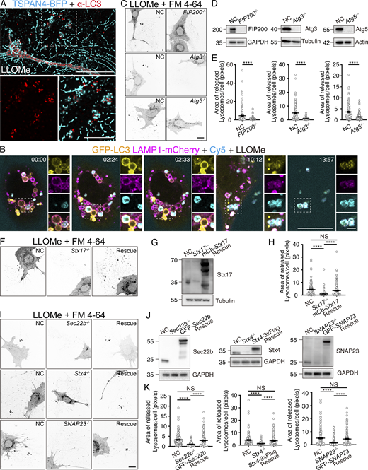 Extracellular release of LAMP1-positive structures required the fusion of autolysosomes and the basal plasma membranes. (A) TSPAN4-BFP stably expressing MEF cell line was treated with 3 mM LLOMe for 22 h and then stained with LC3. The marked region in the large graph was enlarged and demonstrated beneath. Scale bars denoted 20 μm for the large-view graph, 5 μm for the small-view graphs. (B) Time-lapse imaging of GFP-LC3 LAMP1-mCherry stably expressing MEF cells treated with 2 mM LLOMe and stained with Cy5. The first frame was captured about four and a half hours after LLOMe addition. The marked regions were enlarged and demonstrated on their right. Scale bars denoted 20 μm for the large-view graphs, 2 μm for the small-view graphs. The complete process can be observed in Video 6. (C) Control, FIP200−/−, Atg3−/− and Atg5−/− MEF cells were treated with 2.5 mM LLOMe for 22 h then fixed and stained with FM 4-64. The representative images of each group were converted into gray-value mode. The scale bar denoted 20 μm. (D) Western blot results of the samples from experiments in C. Knocking Out efficiency of FIP200, Atg3 and Atg5 was verified respectively. (E) Statistic results of the area of extracellular lysosomal structure of FIP200−/−, Atg3−/− and Atg5−/− MEF cells in C. Error bars denoted ± SEM from three independent fixed-cell imaging experiments, 50 cells were analyzed per experiment and 150 cells were analyzed in total for each group. T test, ****P < 0.0001. (F) Control, Syntaxin17−/− and mCherry-Syntaxin17 Rescue MEF cells were treated with 2.5 mM LLOMe for 22 h then fixed and stained with FM 4-64. The representative images were converted into gray-value mode. The scale bar denoted 20 μm. (G) Western blot result of the samples from experiments in F. Knocking Out and rescue efficiency of Syntaxin17 was verified. (H) Statistic results of the area of extracellular lysosomal structure of groups in F. Error bars denoted ± SEM from three independent fixed-cell imaging experiments, 50 cells were analyzed per experiment and 150 cells were analyzed in total for each group. T test, ****P < 0.0001, NS = not statistically significant. (I) Control, Sec22b−/− and GFP-Sec22b Rescue; Control, Syntaxin4−/− and GFP-Syntaxin4 Rescue; Control, SNAP23−/− and GFP-SNAP23 Rescue MEF cells were treated with 2.5 mM LLOMe for 22 h then fixed and stained with FM 4-64. The representative images were converted into gray-value mode. The scale bar denoted 20 μm. (J) Western blot results of the samples from experiments in I. Knocking Out and rescue efficiency of Sec22b, Syntaxin4 and SNAP23 was verified respectively. (K) Statistic results of the area of extracellular lysosomal structure of groups in I. Error bars denoted ± SEM from three independent fixed-cell imaging experiments, 50 cells were analyzed per experiment and 150 cells were analyzed in total for each group. T test, ****P < 0.0001, NS = not statistically significant. Source data are available for this figure: SourceData F3.