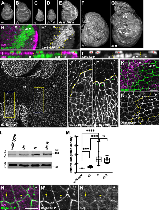 Both Ft and Ds suppress tissue growth by regulating localization and abundance of Dachs at the junctional cortex. (A–G) Representative wing discs stained with phalloidin showing the growth defects of the following genotypes: wild-type (A), dsUAO71 (B), dachsGC13 (C), dsUAO71ftG-rvdachsGC13/dsUAO71ftfddachsGC13 (D), dsUAO71ftG-rvdachsGC13/dsUAO71ftfd (E), ftG-rv/ftfd (F), and dsUAO71ftG-rv/dsUAO71ftfd (G). Panels F and G were stitched together because of their large size (see Materials and methods). (H) Expression of ban3-GFP, a Hippo pathway reporter, compared between ftG-rv/ftfd (or dsUAO71ftG-rv/ftfd) cells and dsUAO71ftGr-v cells in the wing disc. ban3-GFP is more highly expressed in dsUAO71ftG-rv cells than in ft mutant cells. ds ft clones are marked by the absence of Ds staining. (I) XZ section indicated by the blue dashed line in H. Red asterisks indicate ban3-GFP expression in peripodial cells. (J) Comparison of Dachs:GFP levels and subcellular localization in wild-type, dsUAO71, and ftfd mutant cells. (J′) In ds mutant cells, Dachs:GFP levels were slightly increased and primarily localized to the junctional cortex (J and J′). (J″) In ft mutant cells, Dachs:GFP levels increased more than in ds cells and localized both at the junctional cortex and to non-junctional puncta (J and J″). Clone boundaries and genotypes were determined by anti-Ft staining (Fig. S1 A). (K and K′) In comparison to ft cells, ds ft mutant cells displayed even more Dachs:GFP at the junctional cortex but lacked the non-junctional puncta. (L and M) IB analysis showing Dachs levels in imaginal tissue from wild-type (number matches the n for each of the following genotypes), dsUAO71(n = 5), ftG-rv/ftfd (n = 16), and dsUAO71ftG-rv/dsUAO71ftfd (n = 9). Dachs abundance increases slightly in ds but is much greater in ft and ds ft imaginal tissue. (M) Relative Dachs levels normalized to α-Tubulin. ****P < 0.0001, *** 0.0001 < P < 0.001, ns not significant (two-tailed unpaired t test between each genotype). (N) Localization of Ds and Dachs:GFP in the absence of Ft. Dachs:GFP was highly localized to the junctional cortex and colocalized with Ds in non-junctional puncta (yellow arrows). Scale bars: (A–G) 100 µm, (H–K and N) 5 µm. In this and all subsequent figures, fluorescently tagged proteins were viewed by native fluorescence. Antibody staining is indicated by an “α” symbol before the protein name. Yellow dashed lines indicate clone boundaries in this and subsequent figures (except where noted otherwise). Source data are available for this figure: SourceData F1.