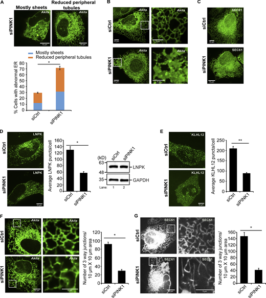 Fewer ER junctions are present at the cell periphery in PINK1-depleted cells. (A) siCtrl and siPINK1-treated cells transfected with Akita-sfGFP were quantitated as described in the methods. (B) Frames from representative 3D reconstructions of Z stacks of siCtrl (22 s in Video 2) and siPINK1-treated (23 s in Video 3) cells. (C) Compressed Z stacks of siCtrl and siPINK1-treated cells transfected with GFP-SEC61. A total of 27 slices were compressed for the siCtrl, and 19 slices for siPINK1-treated cells. (D) Left, representative images of LNPK-GFP in siCtrl and siPINK1-treated cells. Middle, the average number of LNPK puncta/cell. The data was normalized as described in the methods. Right, blots showing LNPK levels. GAPDH was used as a loading control. (E) Left, representative images used in the quantitation shown on the right. (F) Left, representative images of cells containing Akita-sfGFP with insets used in the quantitation (right) of junctions. (G) Same as E only, cells were transfected with mCherry-Sec61. Error bars represent SEM, n = 3 independent experiments. The results were quantified from 93 to 116 cells in A, 78–82 cells in D, 84–85 cells in E, 27–32 cells in F, and 51–59 cells in G. * (P < 0.05), **(P < 0.01), Student’s unpaired t test. Source data are available for this figure: SourceData F6.