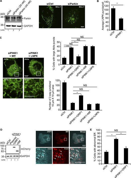 Related toFigs. 5, 6, and 7. mCherry-DRP1 suppresses the ER morphology defect in siPINK1-treated cells. (A) Left, western blot analysis was performed using cell lysates depleted of Parkin. Samples were blotted for Parkin and GAPDH. Right, representative images of GFP-Mito7 in Ctrl and siParkin-treated cells. (B) Same as Fig. 6 D middle, only the data was not normalized. (C) siCtrl and siPINK1-treated cells containing Akita-sfGFP were transfected with mCherry-Mff, or LNPK-mCherry. Left, representative images for the data graphed on the right. The remaining images are shown in Fig. 7 A. (D) Left, siCtrl and siPINK1-treated cells were transfected with mCherry-DRP1 (lane 3) and mCherry-Mff (lane 4) and blotted for the expression of the mCherry fusion proteins. Lane 2 does not contain plasmid. Right, Cells were transfected with mTurquoise2-DRP1 and mCherry-Mff. Arrowheads mark colocalizing puncta on mitochondrial membranes. (E) The percentage of cells with abnormal ER was quantitated as described in the methods. Error bars in B, C, and E represent SEM, n = 3 independent experiments. The results were quantified from 78 to 82 cells in B, 100–195 cells in C, top, 33–38 cells in C, bottom, and 78–154 cells in E. NS: not significant (P ≥ 0.05), * (P < 0.05), *** (P < 0.001), Student’s unpaired t test. Source data are available for this figure: SourceData FS12.