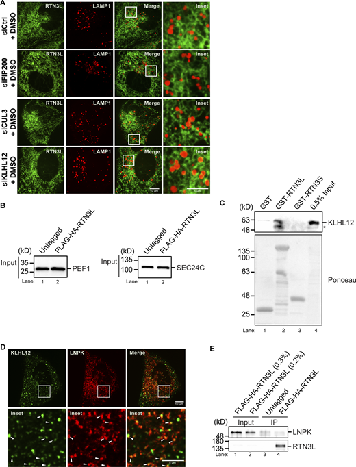 Related toFig. 3. KLHL12 colocalizes with LNPK at junctions. (A) Representative DMSO control images of YFP-RTN3L puncta with LAMP1-mCherry structures in siCtrl, siFIP200, siCUL3, and siKLHL12-treated cells for the data shown in Fig. 3 A. (B) Inputs for PEF1 and SEC24C for the precipitates that are shown in Fig. 3 C. (C) The in vitro binding experiment was done as in Fig. 1 C only the samples were blotted for the presence of KLHL12. The asterisk marks a breakdown fragment of KLHL12. (D) An image of U2OS cells that were transfected with pHAGE2-LNPK-mCherry and GFP-KLHL12 is shown. Arrowheads mark KLHL12 puncta that colocalize with LNPK puncta. (E) Same as Fig. 3 B, only blotted for the presence of LNPK. Source data are available for this figure: SourceData FS8.