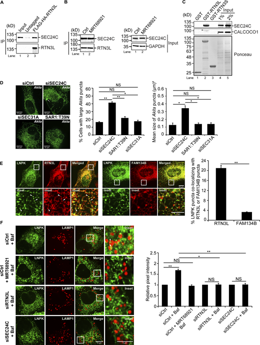 The RTN3L–SEC24C receptor complex mediates traffic to lysosomes from ER junctions independent of COPII vesicle traffic. (A) Lysates were prepared from cells treated with Bafilomycin A1 (Baf) for 4 h and incubated with anti-HA-agarose beads. Input is 0.2% of the lysate. SEC24C inputs were equal (see Fig. S1 A). A 6.56 increase in SEC24C was present in the FLAG-HA-RTN3L precipitate compared with the untagged control. (B) Same as A only, control (Ctrl) cells were treated with Baf or Baf + MRT68921 for 4 h. There was 1.21 × more SEC24C in lane 2 when compared to lane 1 (set to 1.00). The data was normalized to RTN3L levels. (C) In vitro binding experiments performed with lysates prepared from rich or nutrient starved cells yielded the same results. Cells were grown in rich media for the data shown. Asterisk (*) marks a contaminating band. (D) siCtrl, SAR1:T39N transfected cells and siRNA-treated cells were transfected with Akita-sfGFP. The percent cells with large Akita puncta (≥0.5 µm2), and the mean size of Akita puncta are reported. Arrow marks a puncta that was quantitated. (E) Cells were transfected with LNPK–GFP and mCherry–RTN3L or mCherry–FAM134B. Arrowheads mark colocalizing puncta. (F) Cells were untreated or treated with Baf or Baf + MRT68921 (6 h). The relative pixel intensity is reported for images on the left and Fig. S5 B. Arrowheads mark LNPK-GFP puncta colocalizing with LAMP1-mCherry structures. The Ctrl for each condition was without Baf (DMSO) and set to 1.0. Error bars (D–F) represent SEM, n = 3 independent experiments. The results were quantified from 62 to 101 cells in D, 58–61 cells in E, and 63–87 cells for F and Fig. S5 B. NS: not significant (P ≥ 0.05), * (P < 0.05), **(P < 0.01), Student’s unpaired t test. Source data are available for this figure: SourceData F1. Refer to the image caption for details.