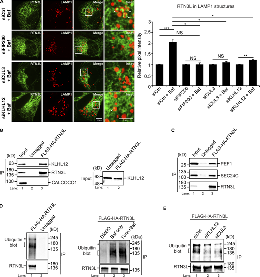 CUL3KLHL12is needed for ER-phagy and the ubiquitination of RTN3L. (A) YFP-RTN3L in LAMP1-mCherry structures in siCtrl and siRNA-treated cells incubated with Baf (4 h). Representative images are shown on the left and in Fig. S8 A. The control for each condition was set to 1.0. (B) RTN3L coprecipitates with KLHL12, but not CALCOCO1. Immunoprecipitations were performed as in Fig. 1 A only the precipitates were eluted using HA peptide as described in the methods. Left, input is 2% of the lysate. Right, equal KLHL12 inputs were used for the immunoprecipitates. (C) Same as B, except the immunoprecipitates were eluted in sample buffer. 4.8 x more PEF1 was precipitated in the tagged sample compared to the untagged control. Input is 2% of the lysate. Equal amounts of PEF1 and SEC24C were used for the immunoprecipitates (see Fig. S8 B). (D) Left, high (asterisks) and low (brackets) molecular weight forms of ubiquitinated RTN3L were detected with ubiquitin antibody. Right, cells were untreated (DMSO) or treated with Baf or Torin 2 + Baf (4 h). (E) The ubiquitination of RTN3L is dependent on KLHL12 and CUL3. Error bars represent SEM, n = 3–6 independent experiments. The results in A were quantified from 59 to 154 cells. NS: not significant (P ≥ 0.05), * (P < 0.05), **(P < 0.01), *** (P < 0.001), Student’s unpaired t test. Source data are available for this figure: SourceData F3. Refer to the image caption for details.