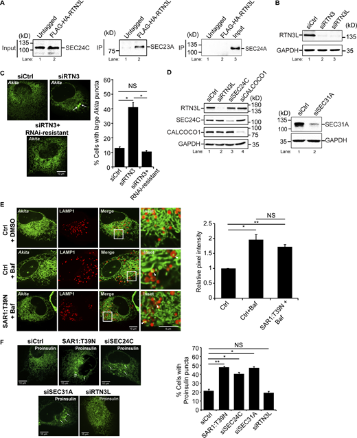 Related toFig. 1. SAR1:T39N does not block the delivery of misfolded Akita to lysosomes. (A) SEC24C coprecipitates with RTN3L. Left, inputs showing that equal amounts of SEC24C were used for the IP in Fig. 1 A. Right, same as Fig. 1 A only the samples were blotted for SEC23A and SEC24A. (B) RTN3 depletion experiments performed in this study were done with two different siRNAs, siRTN3 (directed at a site in the reticulon domain, see details in the Materials and methods) and siRTN3L (directed at two sites in the long domain, see details in the Materials and methods). The same results were obtained with both siRNAs. Western blot analysis was performed using cell lysates treated with siRTN3 and siRTN3L. GAPDH was used as a loading control. (C) RNAi resistant mCherry-RTN3L suppresses the accumulation of large Akita-sfGFP puncta (≥0.5 µm2) in RTN3-depleted cells. Representative images (left) and quantitation of cells with large Akita puncta (right) are shown. Arrows mark large puncta. (D) Western blot analysis was performed using cells treated with siRTN3L, siSEC24C, siCALCOCO1 (left), and siSEC31A (right). GAPDH was used as a loading control. The depletion of RTN3L did not alter the expression of SEC24C or CALCOCO1. (E) Quantitation of Akita-sfGFP puncta in LAMP1-mCherry structures in DMSO treated or Baf treated (3.5 h) cells that were untransfected (Ctrl) or transfected with SAR1:T39N. Arrowheads mark Akita puncta delivered to lysosomes. The data was quantitated as described in the methods. (F) siCtrl, SAR1:T39N, and siRNA-treated cells were transfected with Proinsulin-sfGFP. The percent cells with Proinsulin-sfGFP puncta (≥0.35 µm2) are reported. Arrows mark puncta that were quantitated. Error bars in C, E, and F represent SEM, n = 3 independent experiments. The results were quantified from 29 to 53 cells in C, 65–76 cells in E, and 74–149 cells in F. NS: not significant (P ≥ 0.05), * (P < 0.05), **(P < 0.01), Student’s unpaired t test. Source data are available for this figure: SourceData FS1. Refer to the image caption for details.